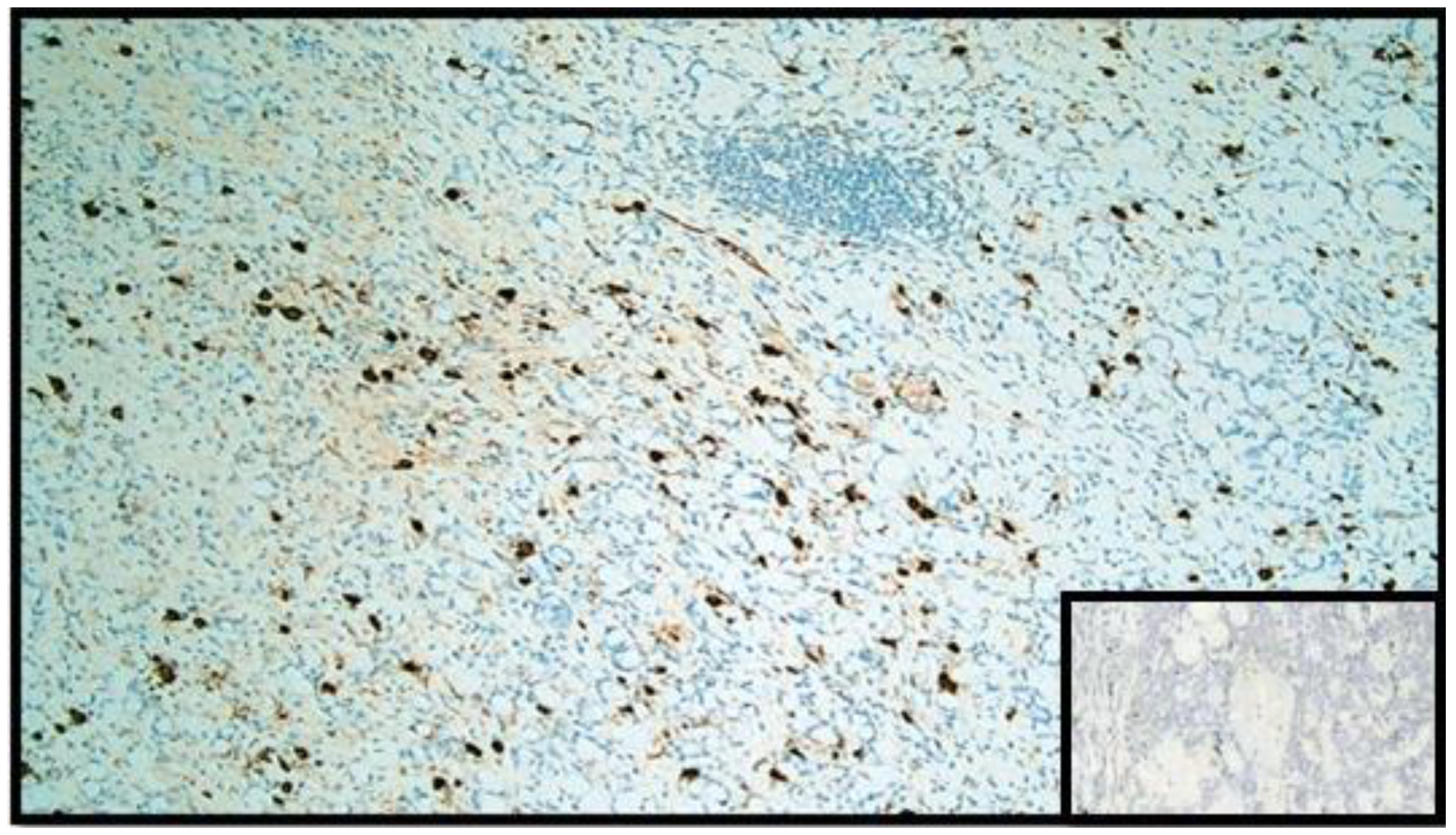 Diseases 10 00077 g005