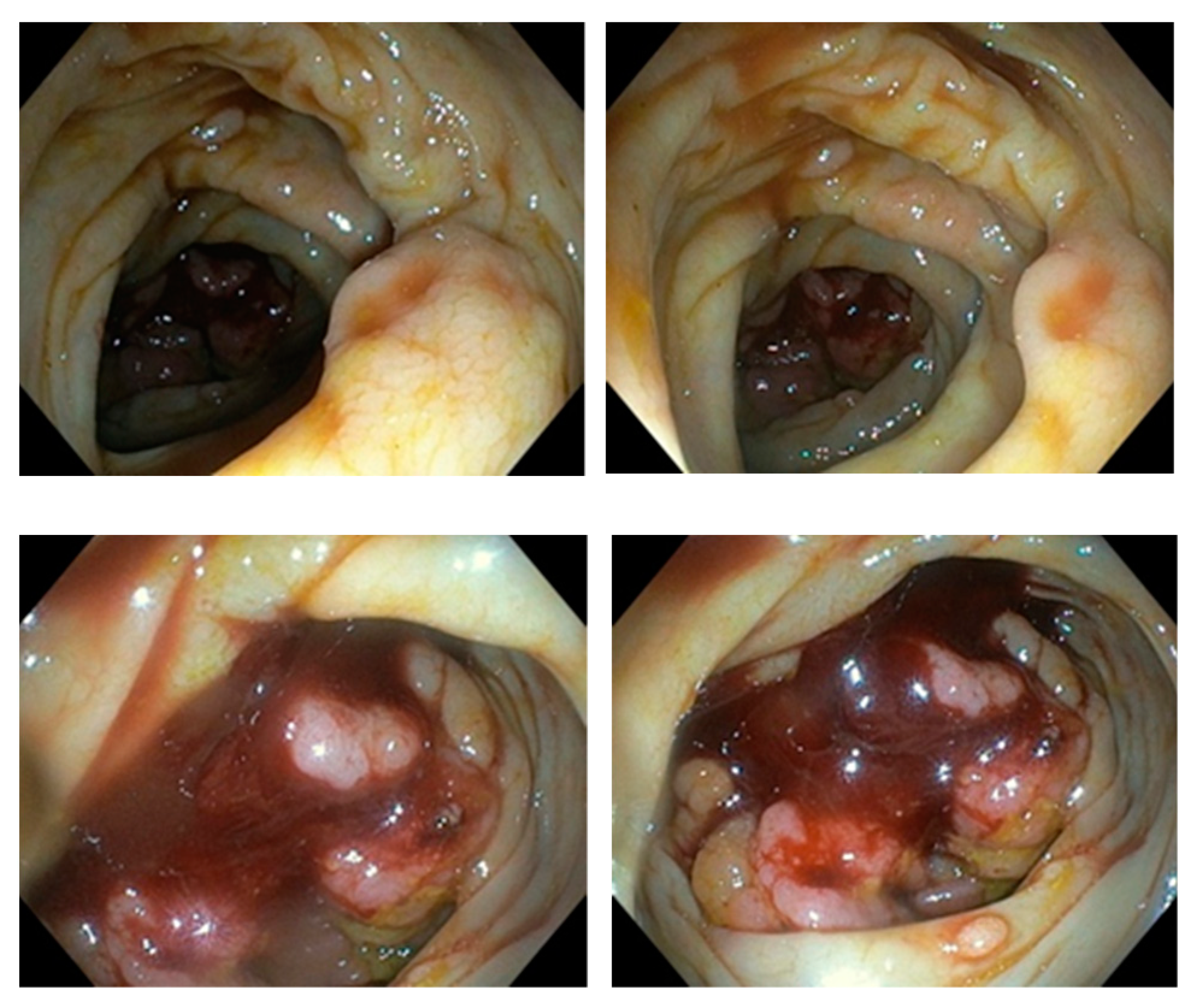 Diseases 10 00079 g003 Diseases 10 00079 g003