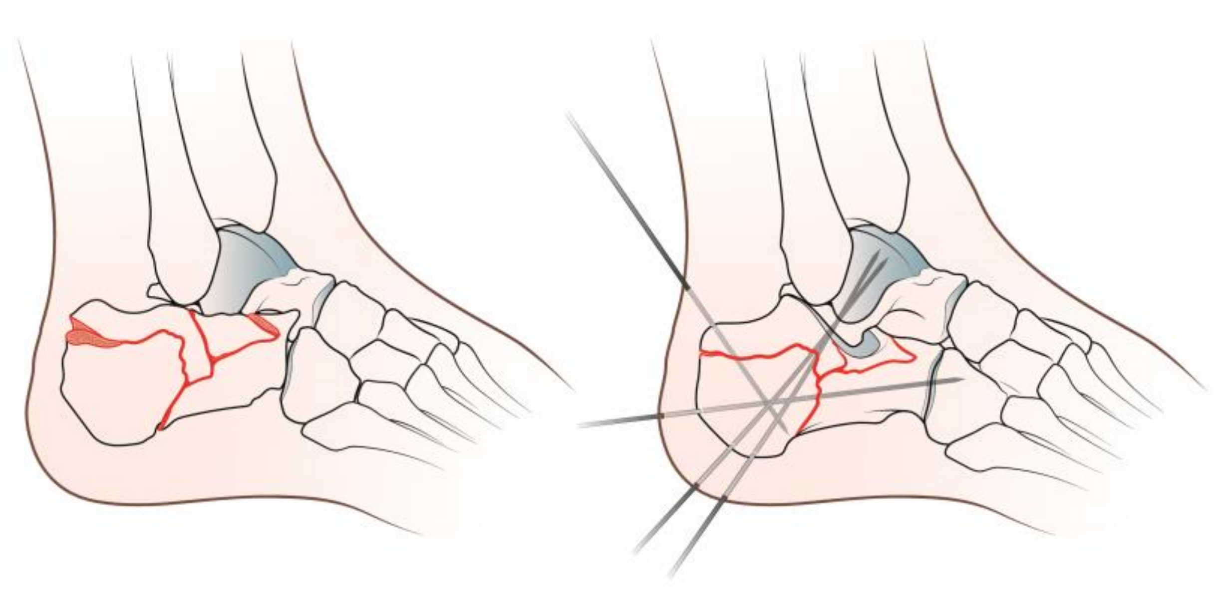 Diseases 11 00057 g001