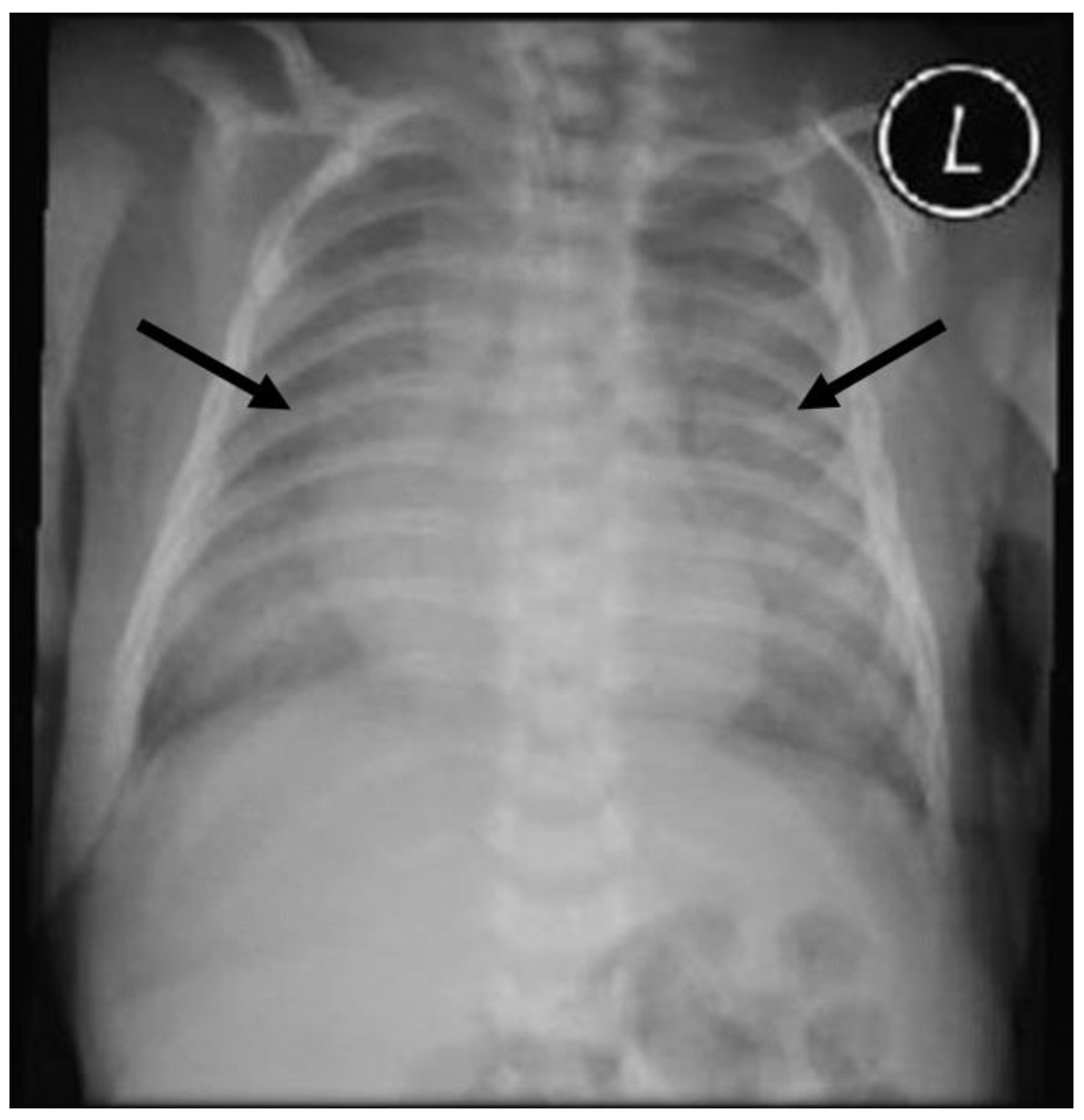 Diseases 11 00067 g001 Diseases 11 00067 g001