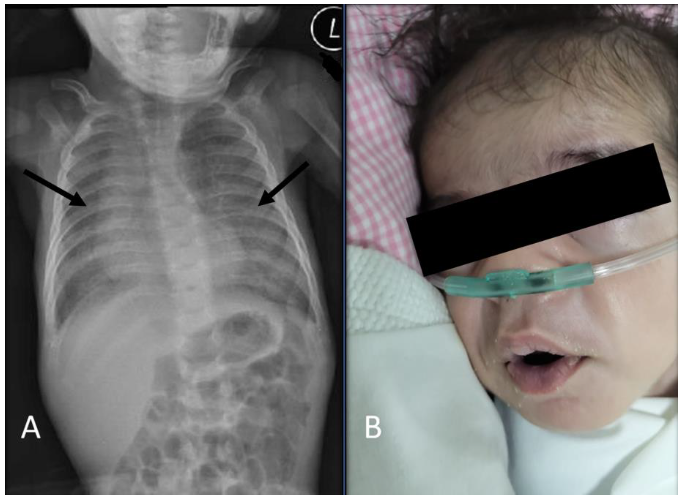 Diseases 11 00067 g003 Diseases 11 00067 g003