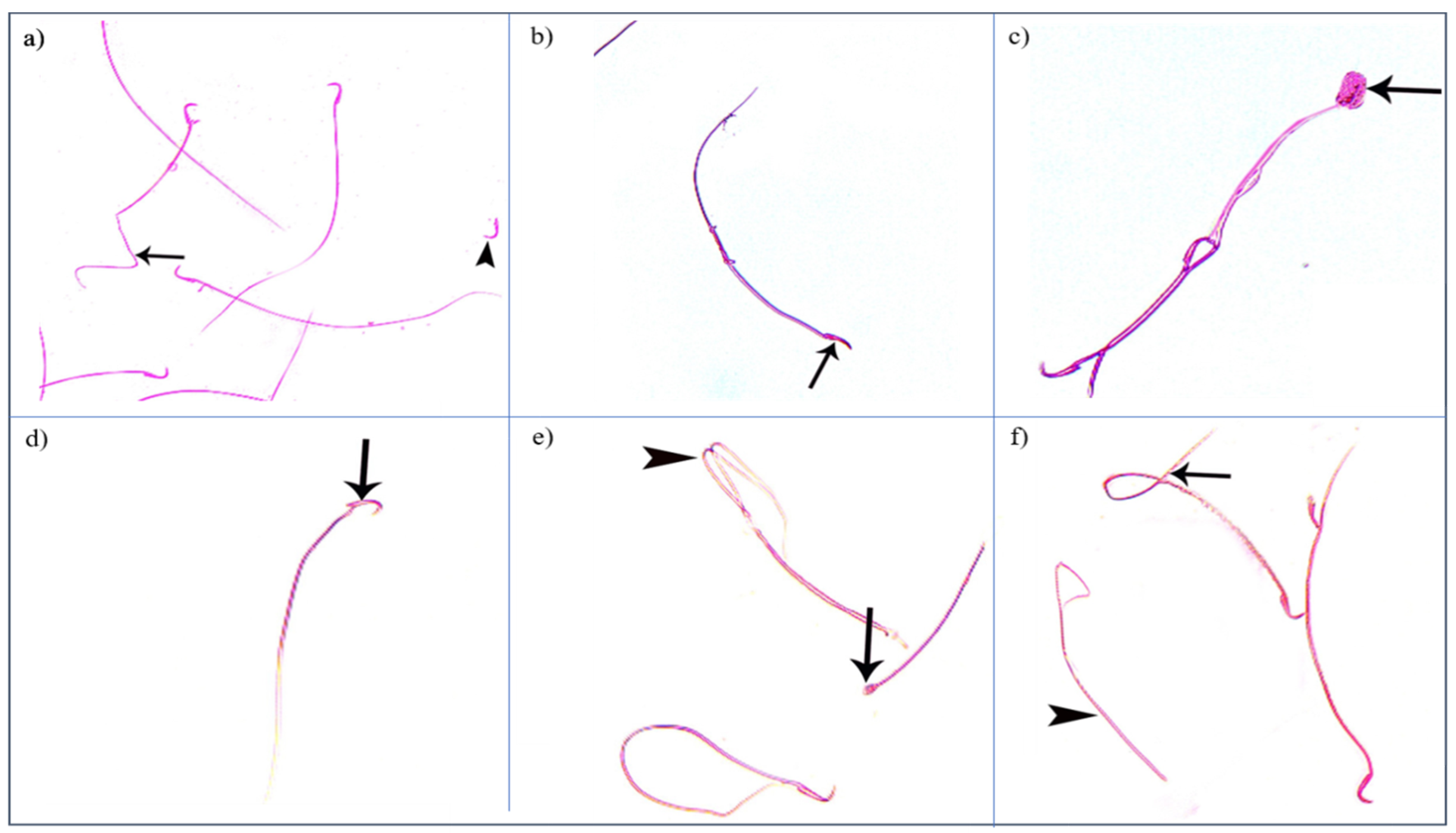 Diseases 11 00084 g009 Diseases 11 00084 g009