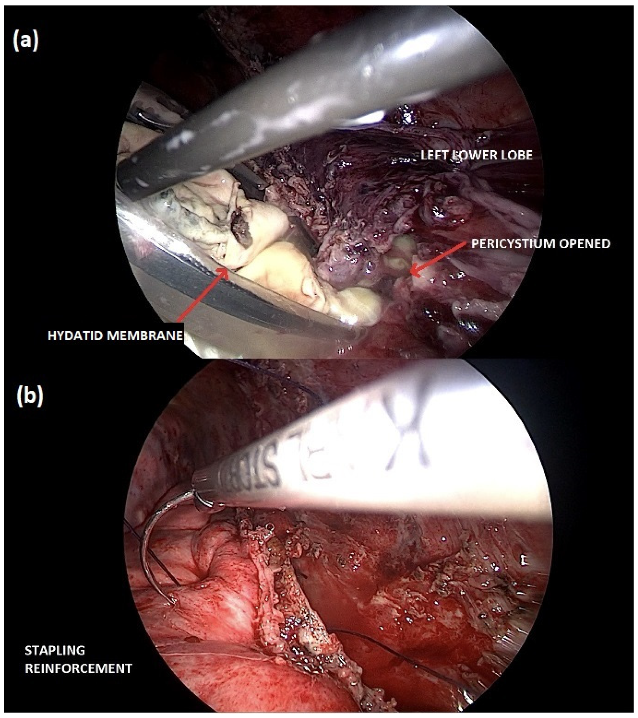 Diseases 11 00090 g002