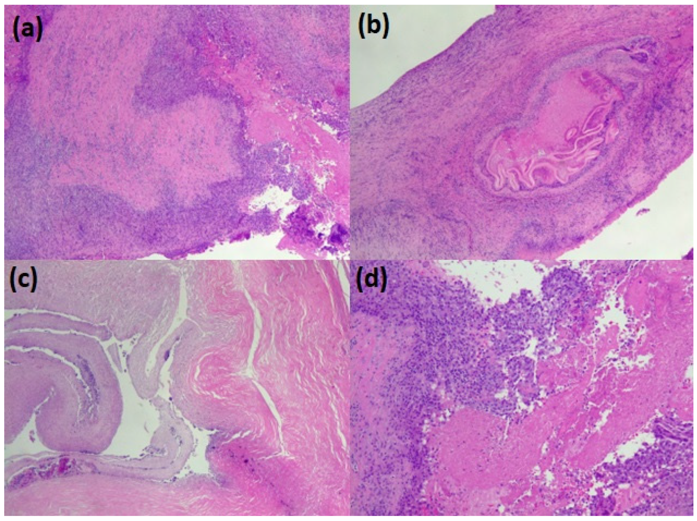 Diseases 11 00090 g003