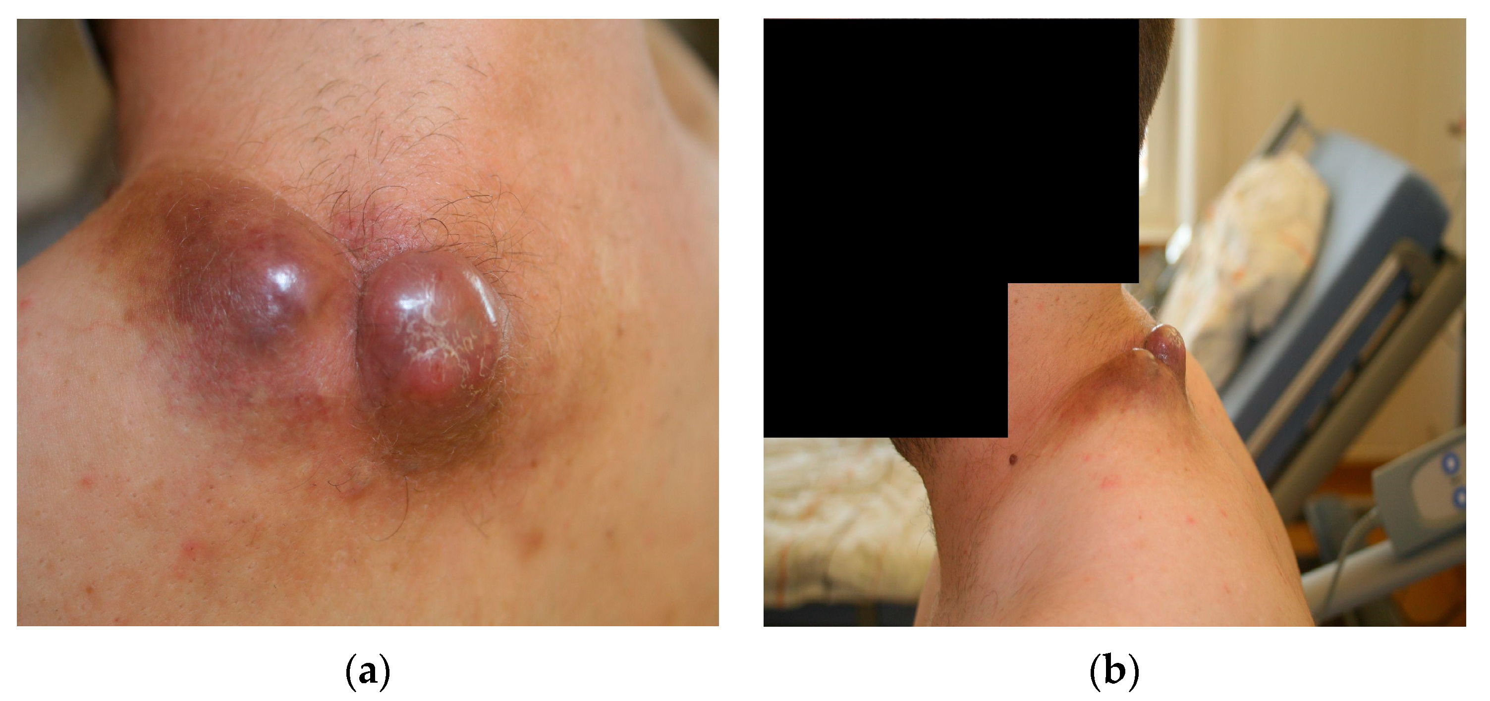 Diseases 11 00108 g001