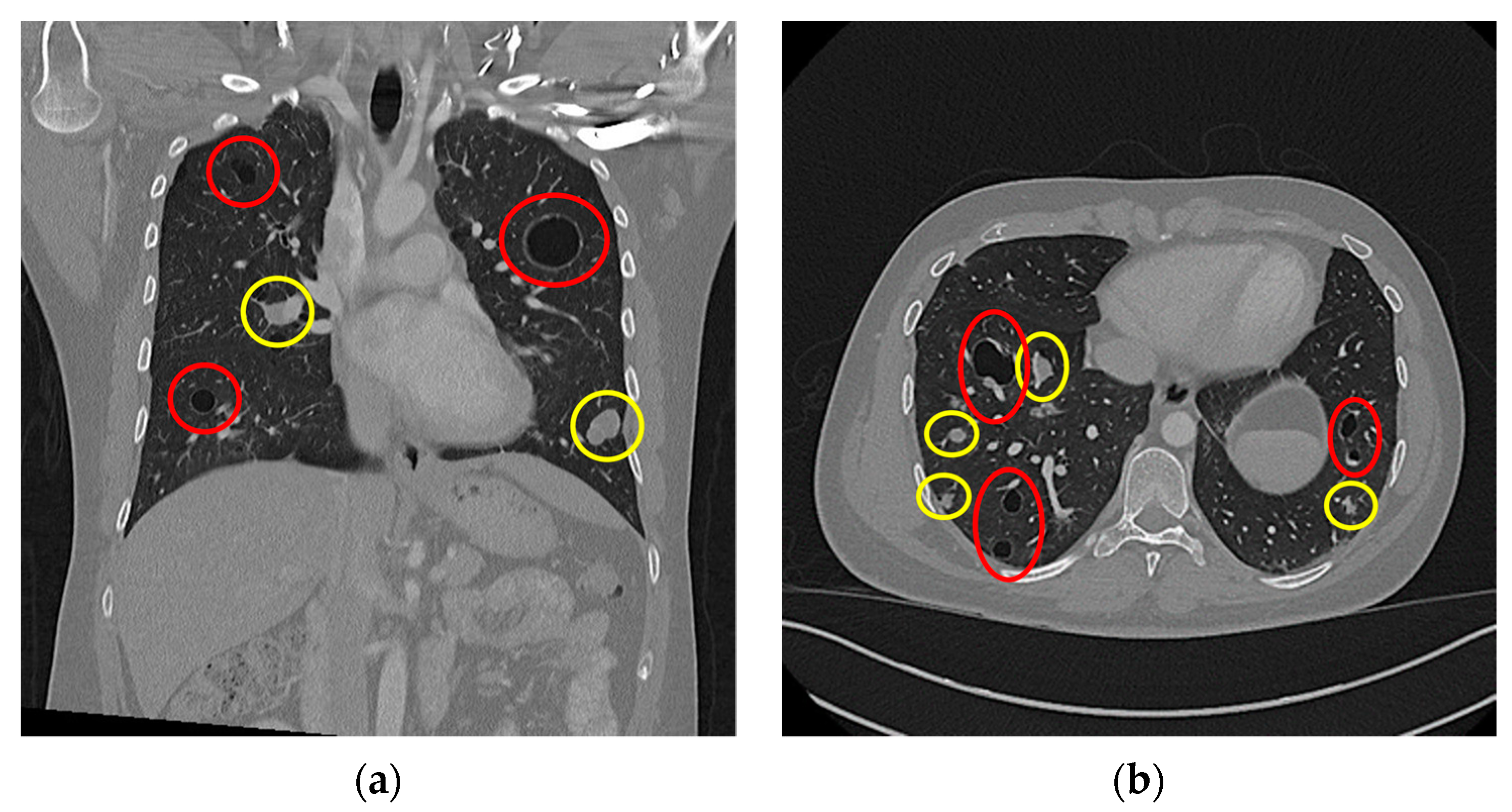 Diseases 11 00108 g003