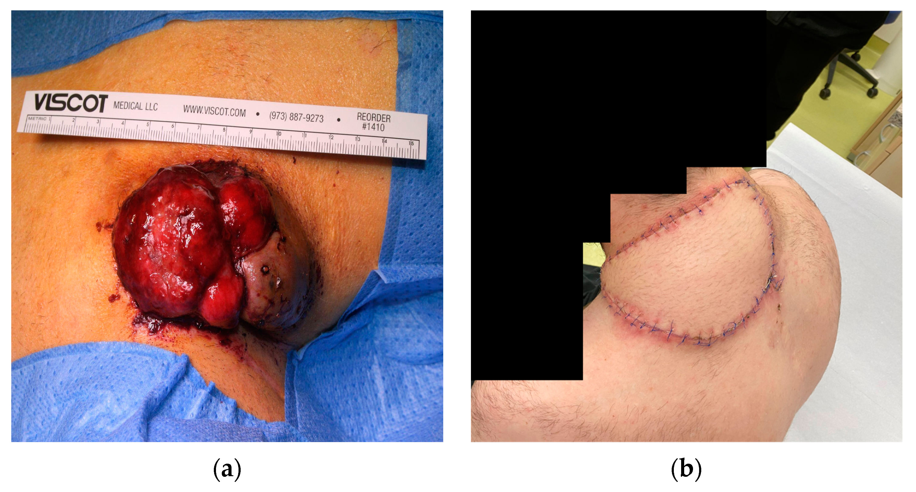 Diseases 11 00108 g005