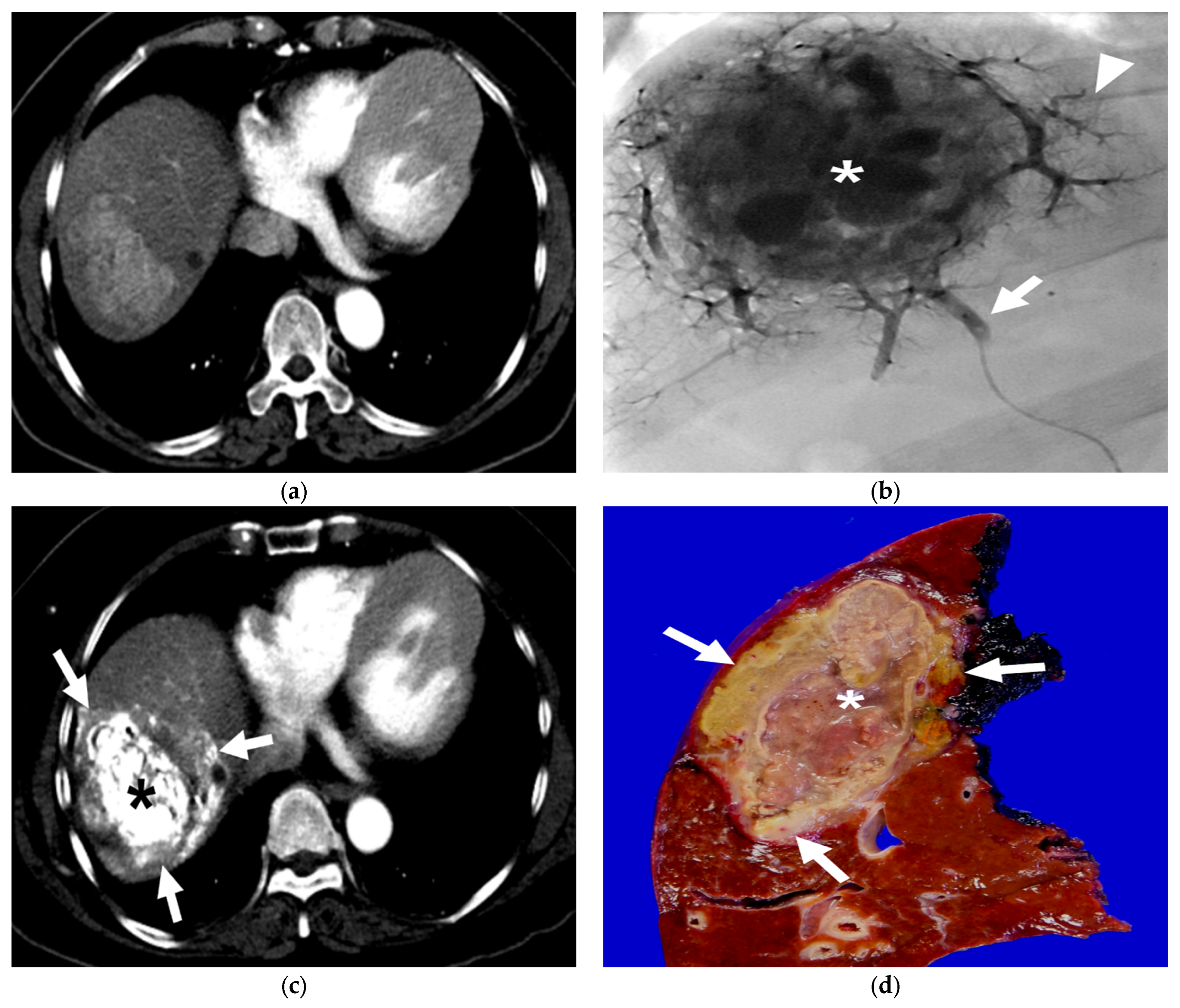 Diseases 11 00149 g003