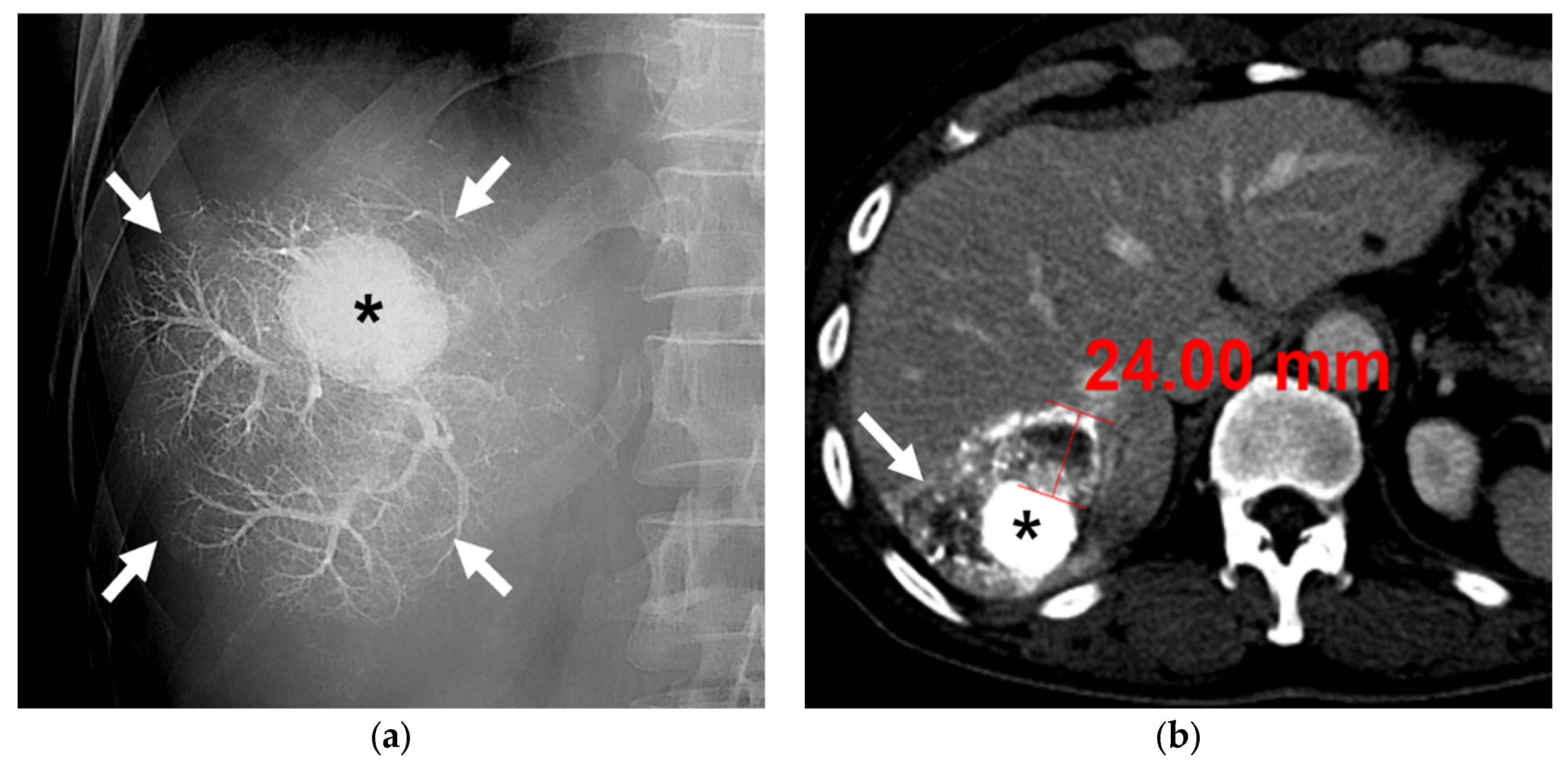 Diseases 11 00149 g004