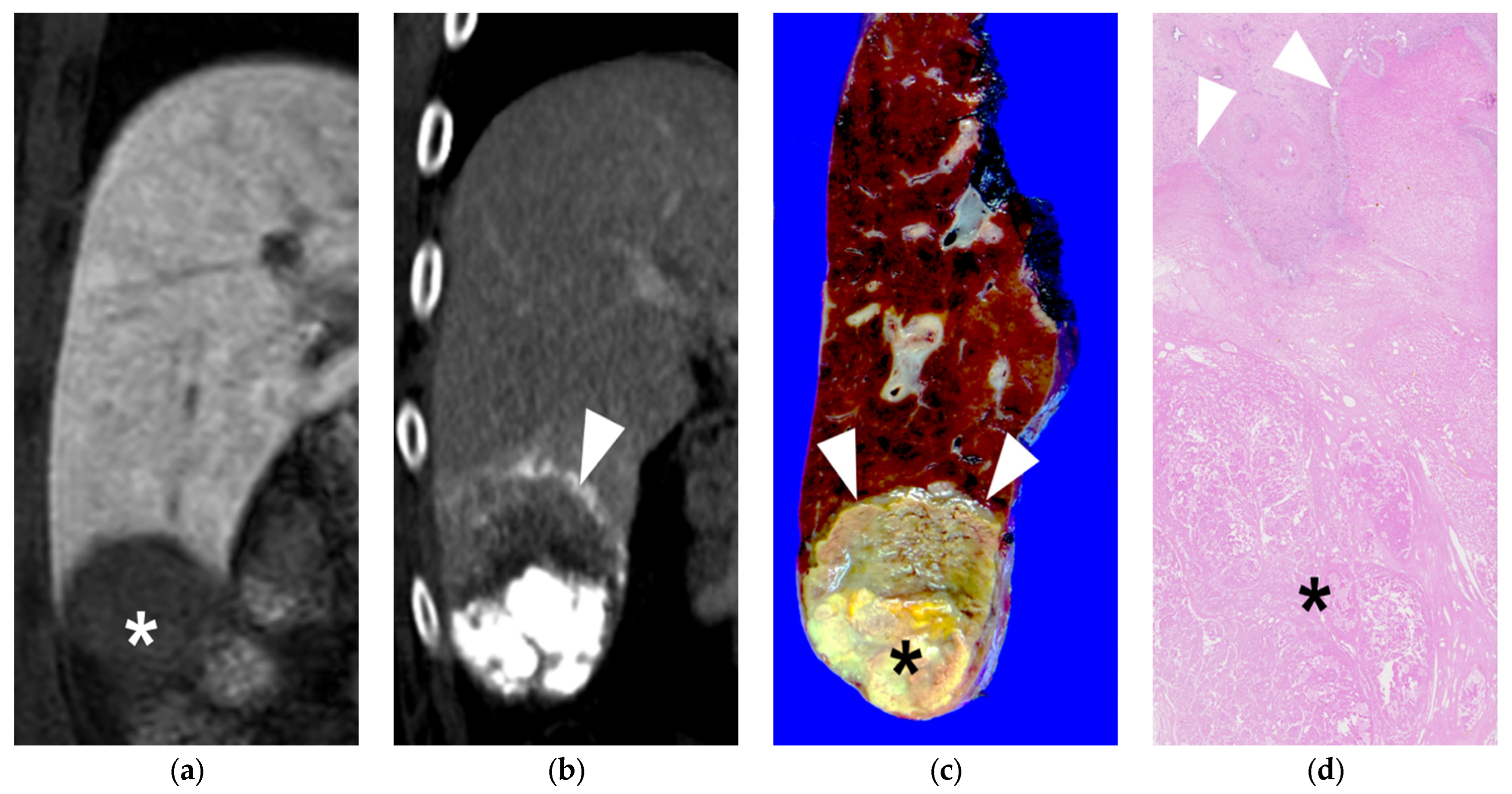 Diseases 11 00149 g005