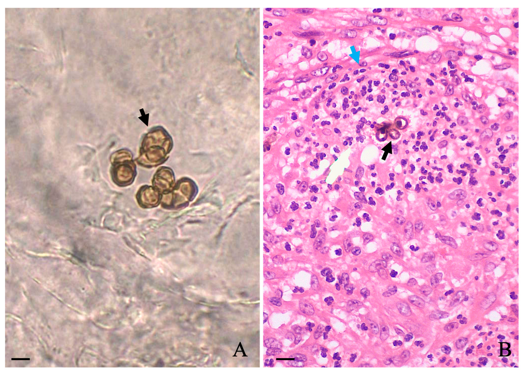 Diseases 11 00162 g001