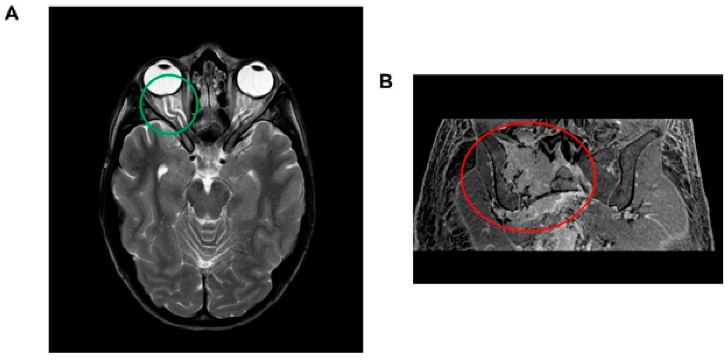 Diseases 11 00167 g001