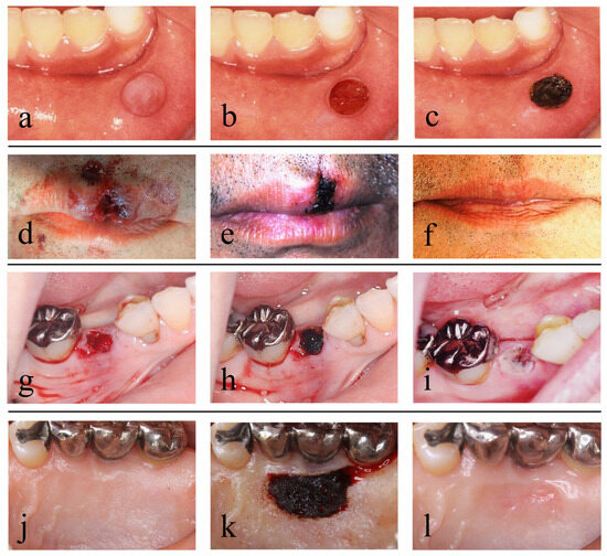 Diseases 11 00172 g002