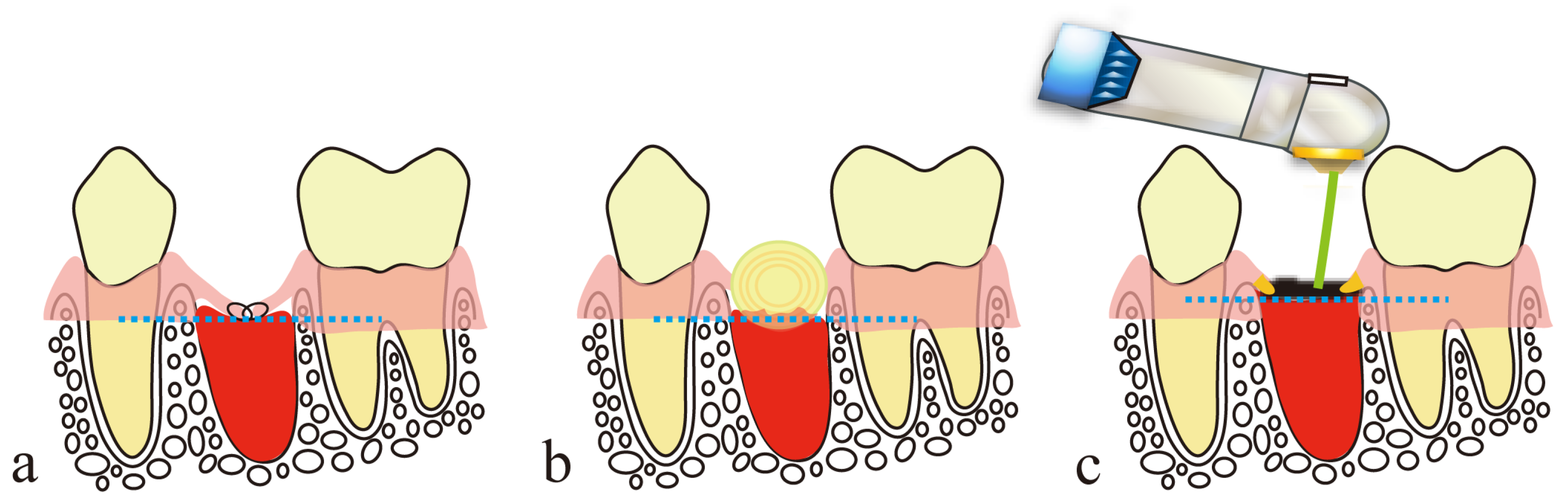 Diseases 11 00172 g005
