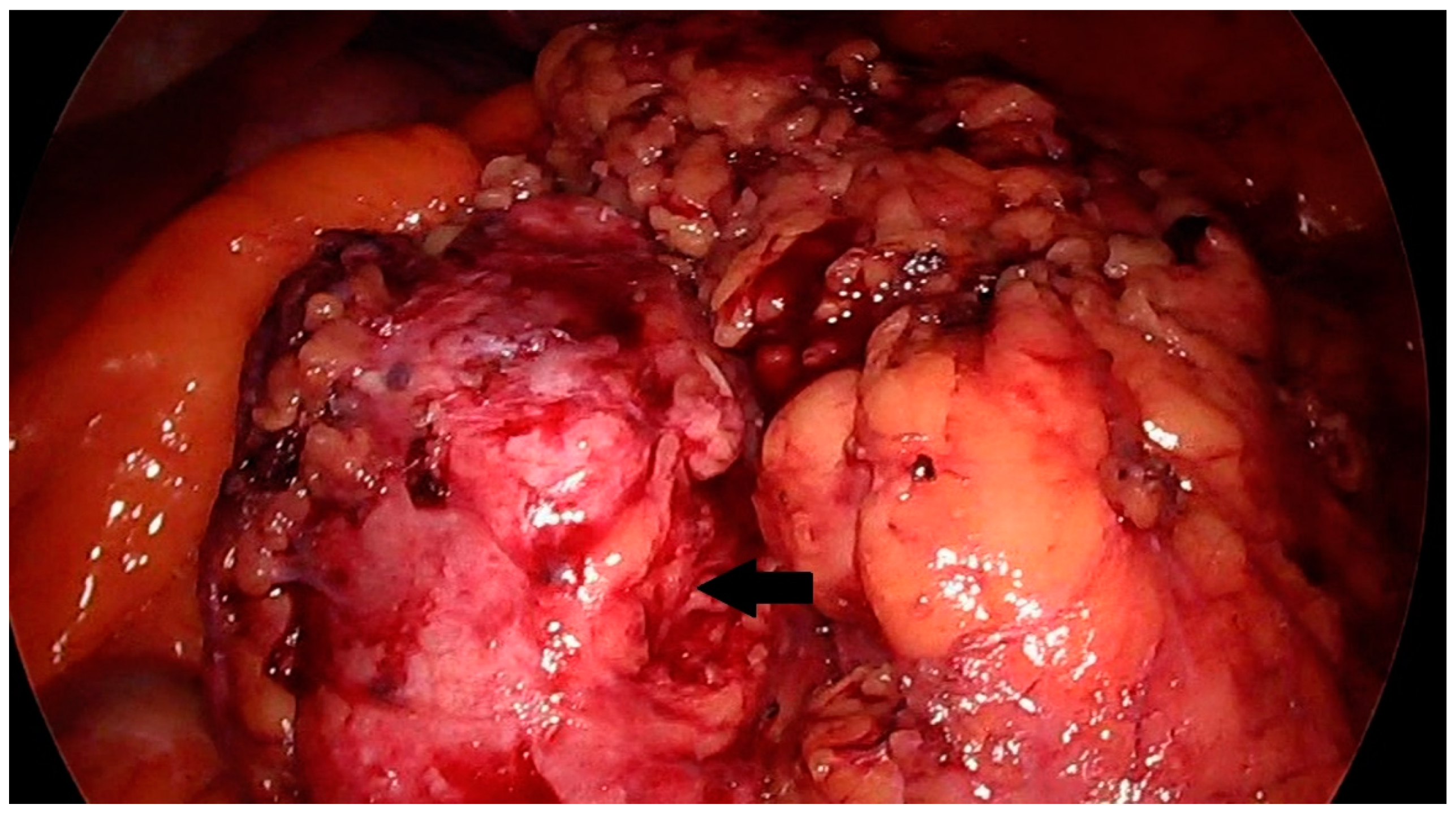 Diseases 12 00006 g002