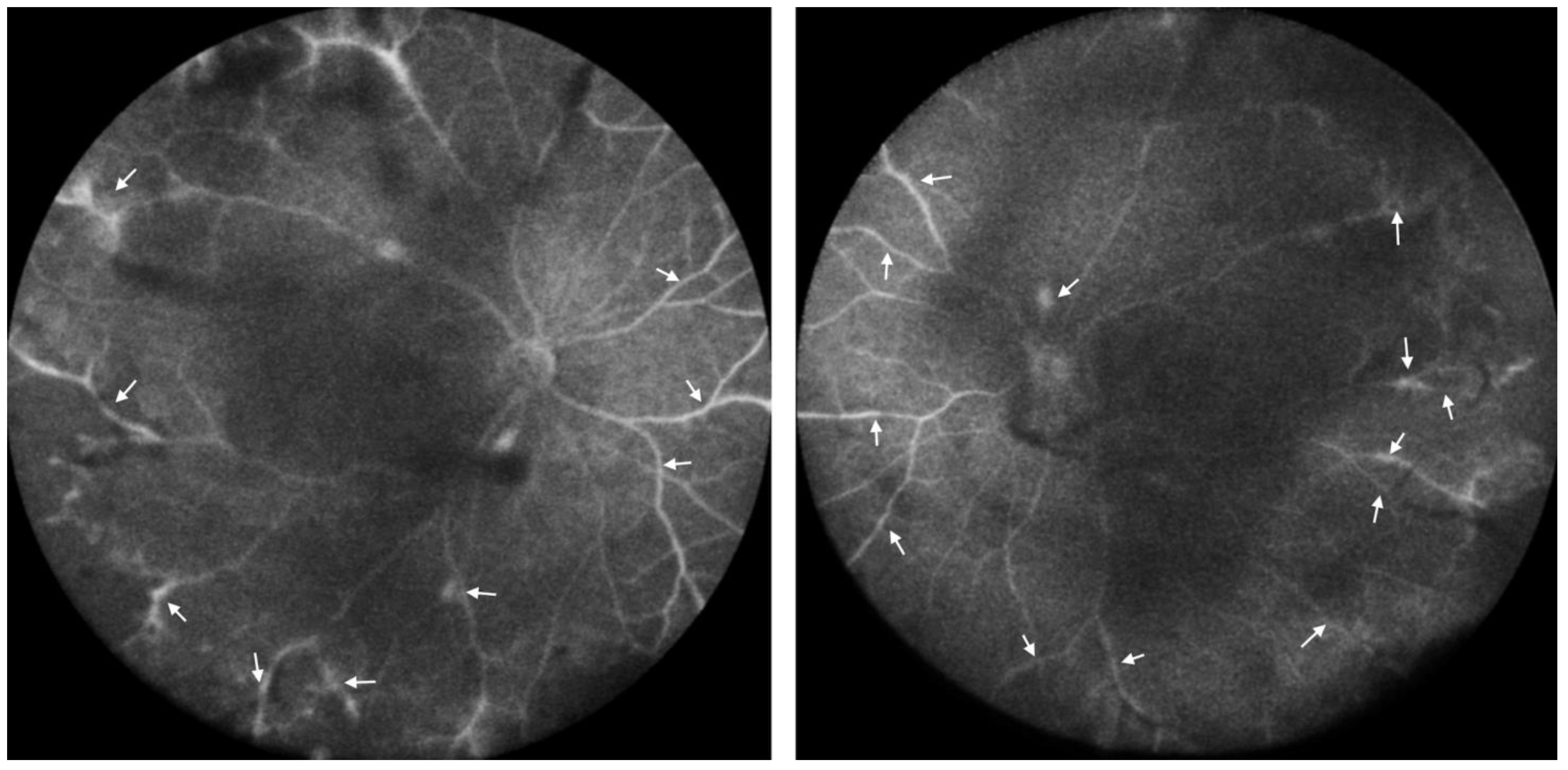 Diseases 12 00036 g004