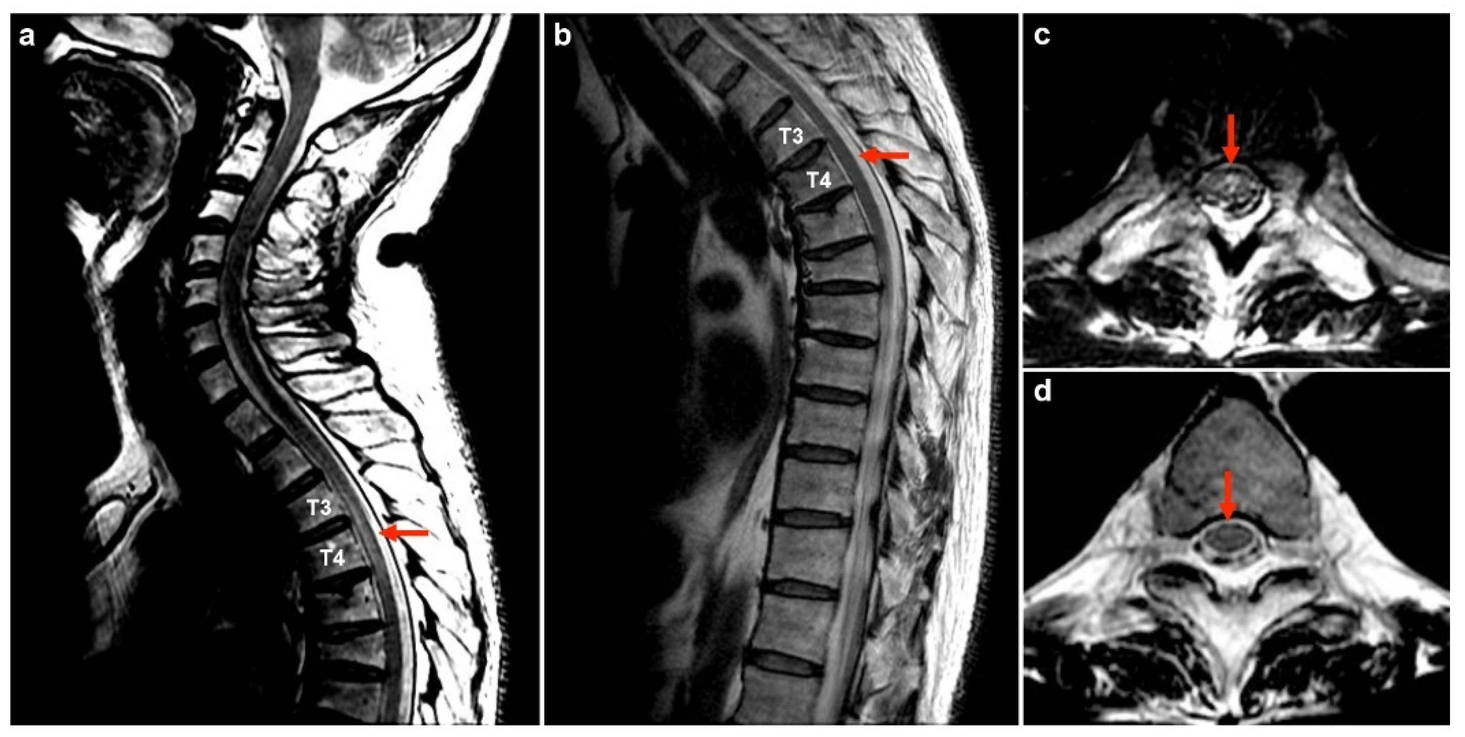 Diseases 12 00060 g001
