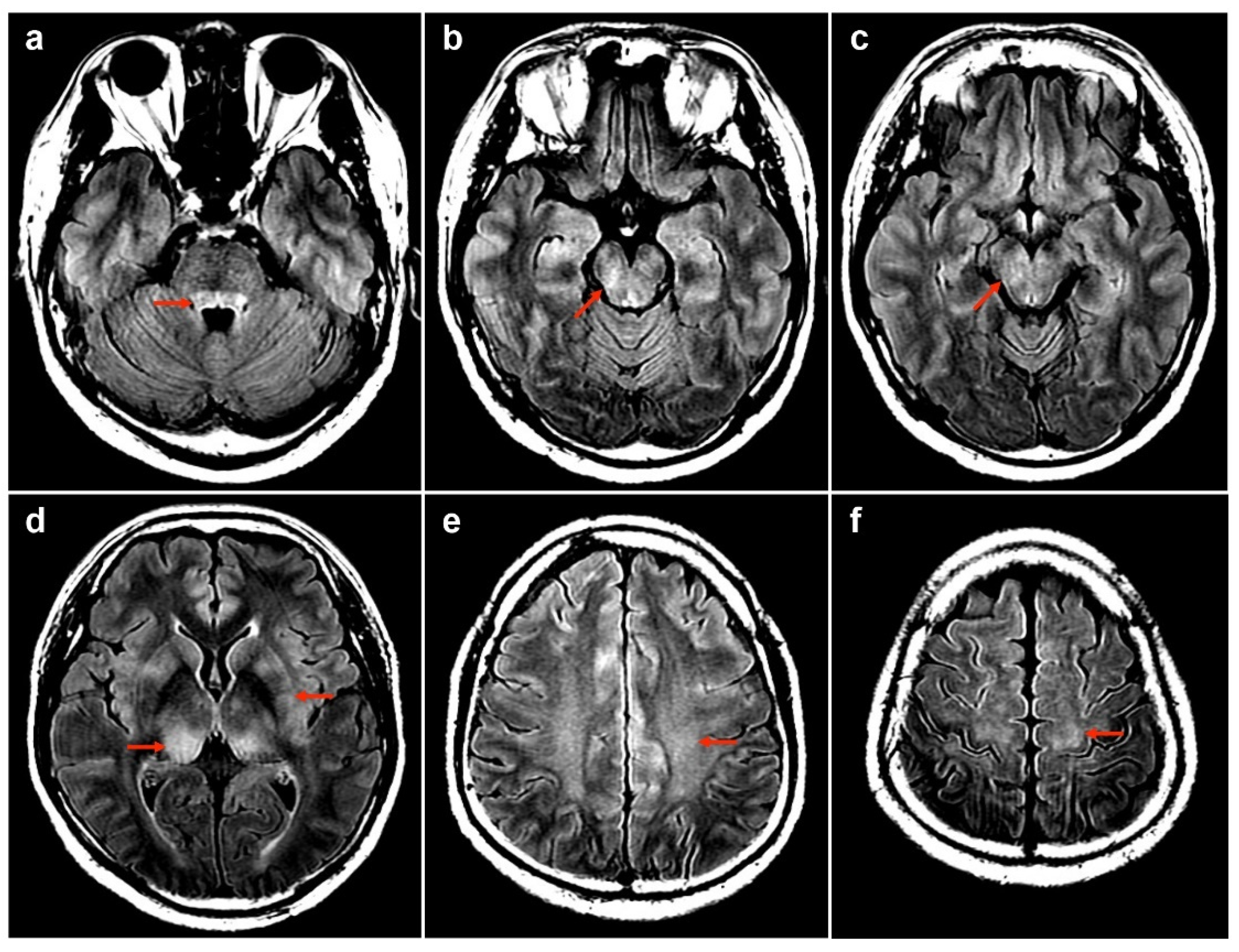 Diseases 12 00060 g002