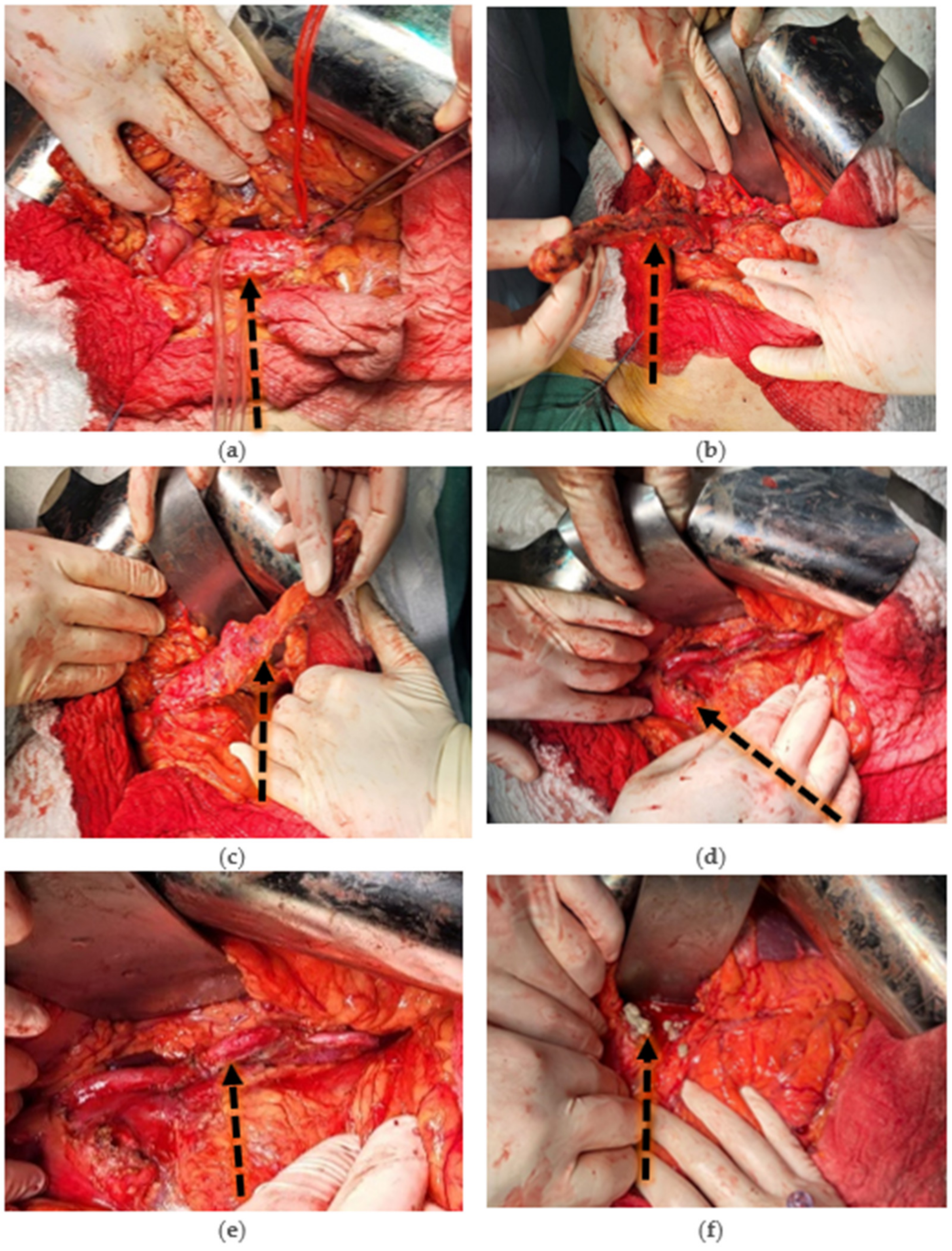 Diseases 12 00086 g003