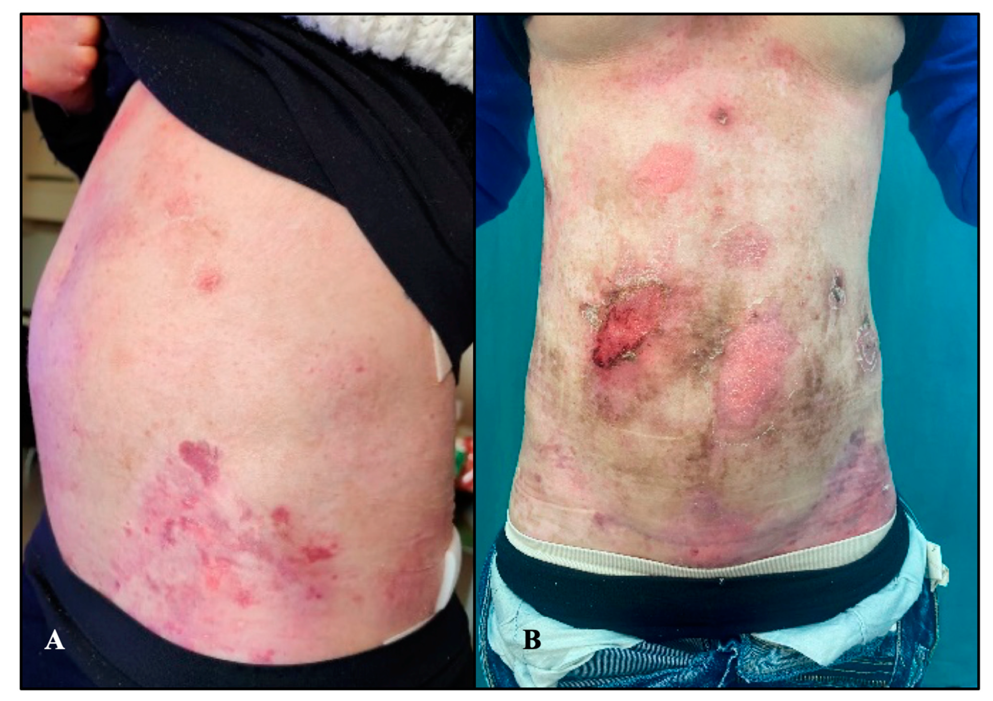 Diseases 12 00104 g001