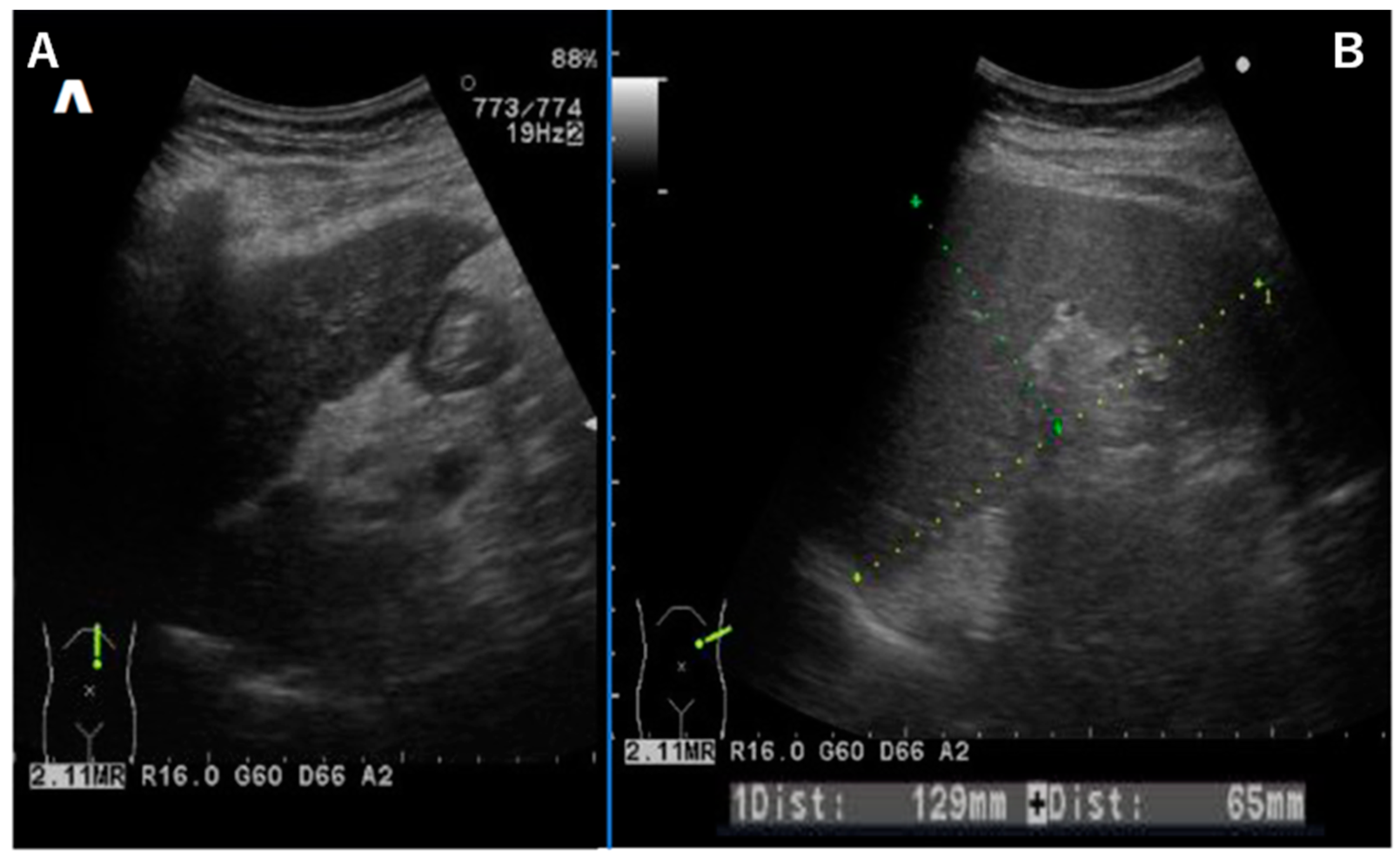 Diseases 12 00251 g002 Diseases 12 00251 g002