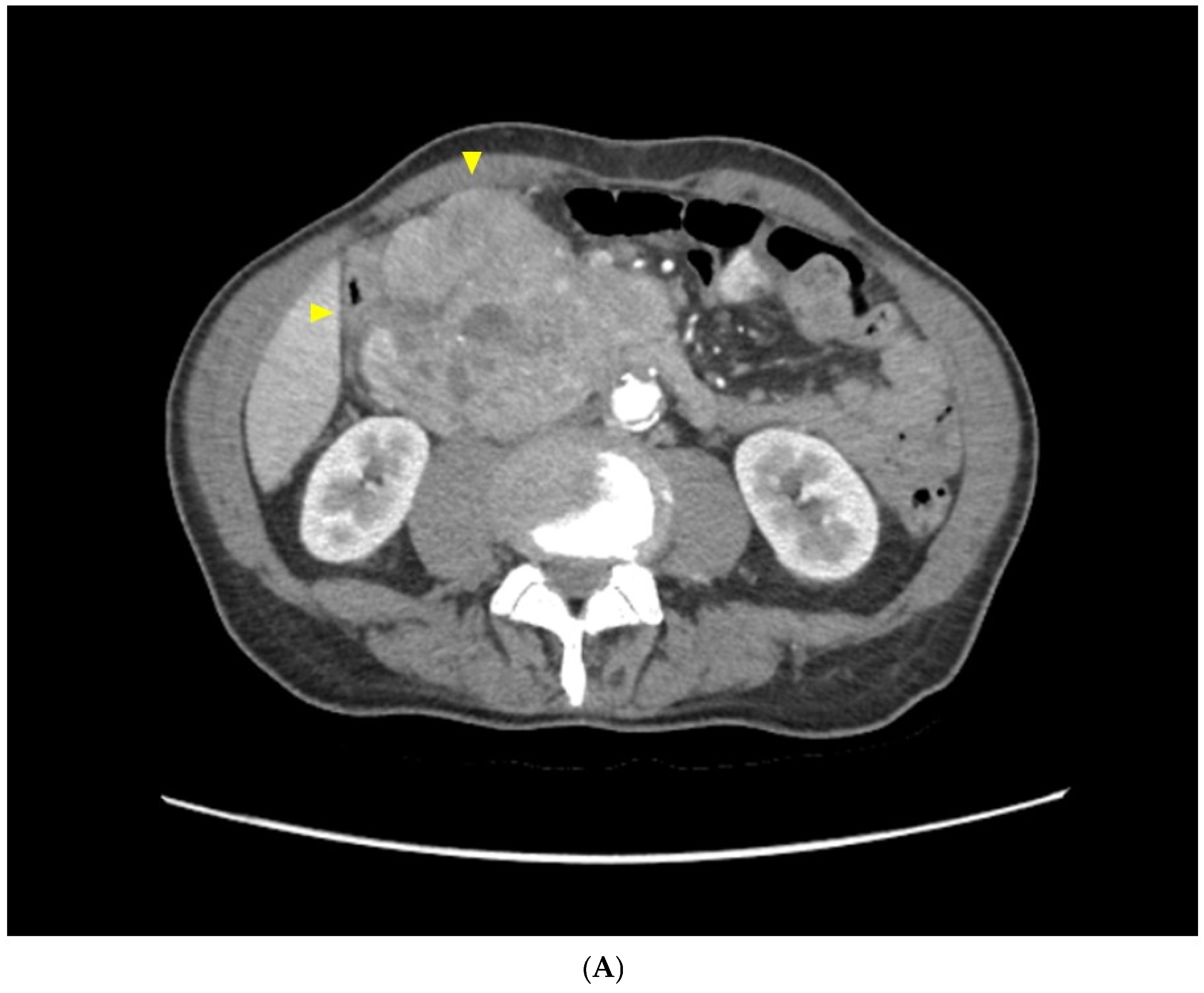Diseases 12 00259 g001a