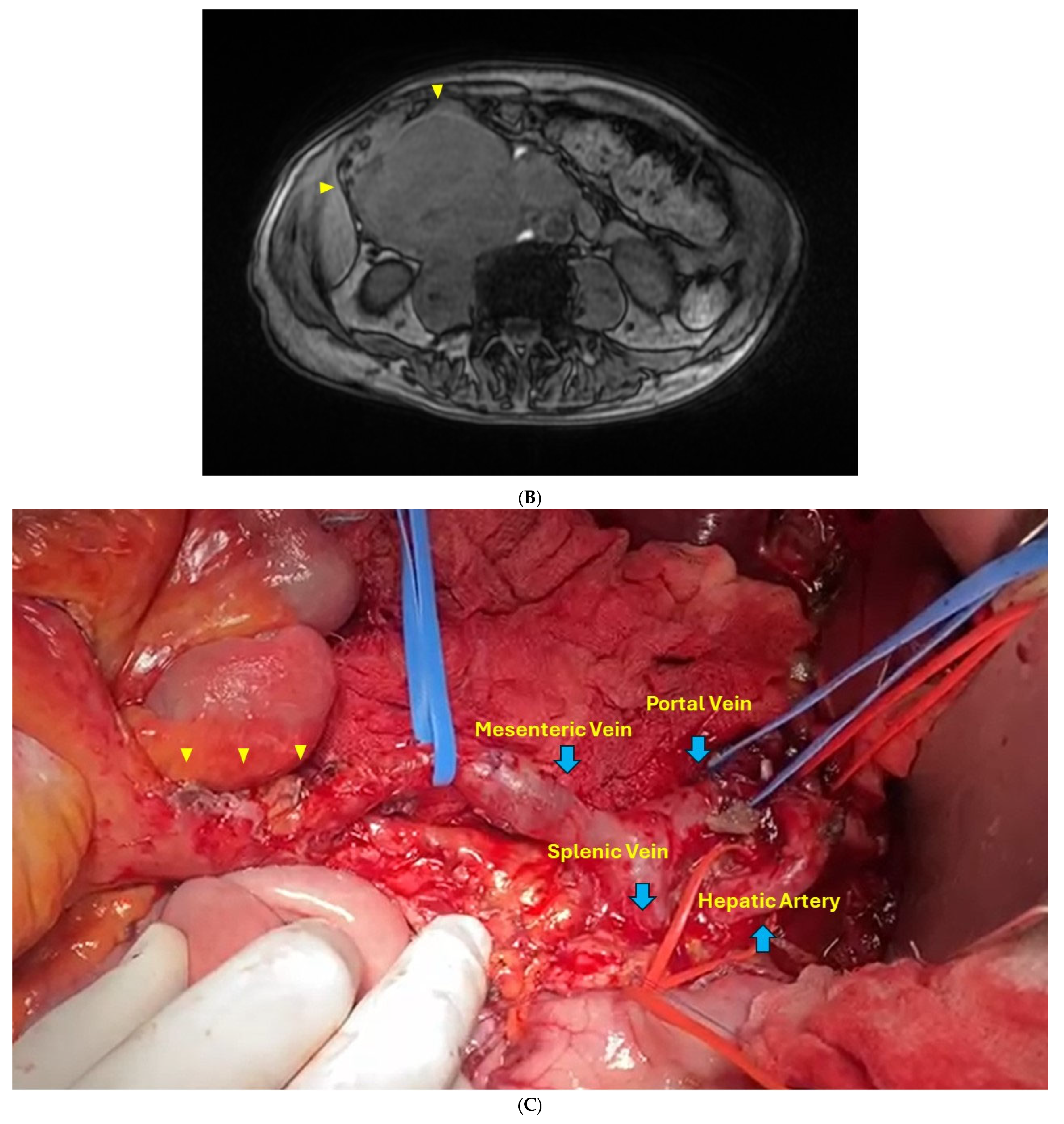 Diseases 12 00259 g001b