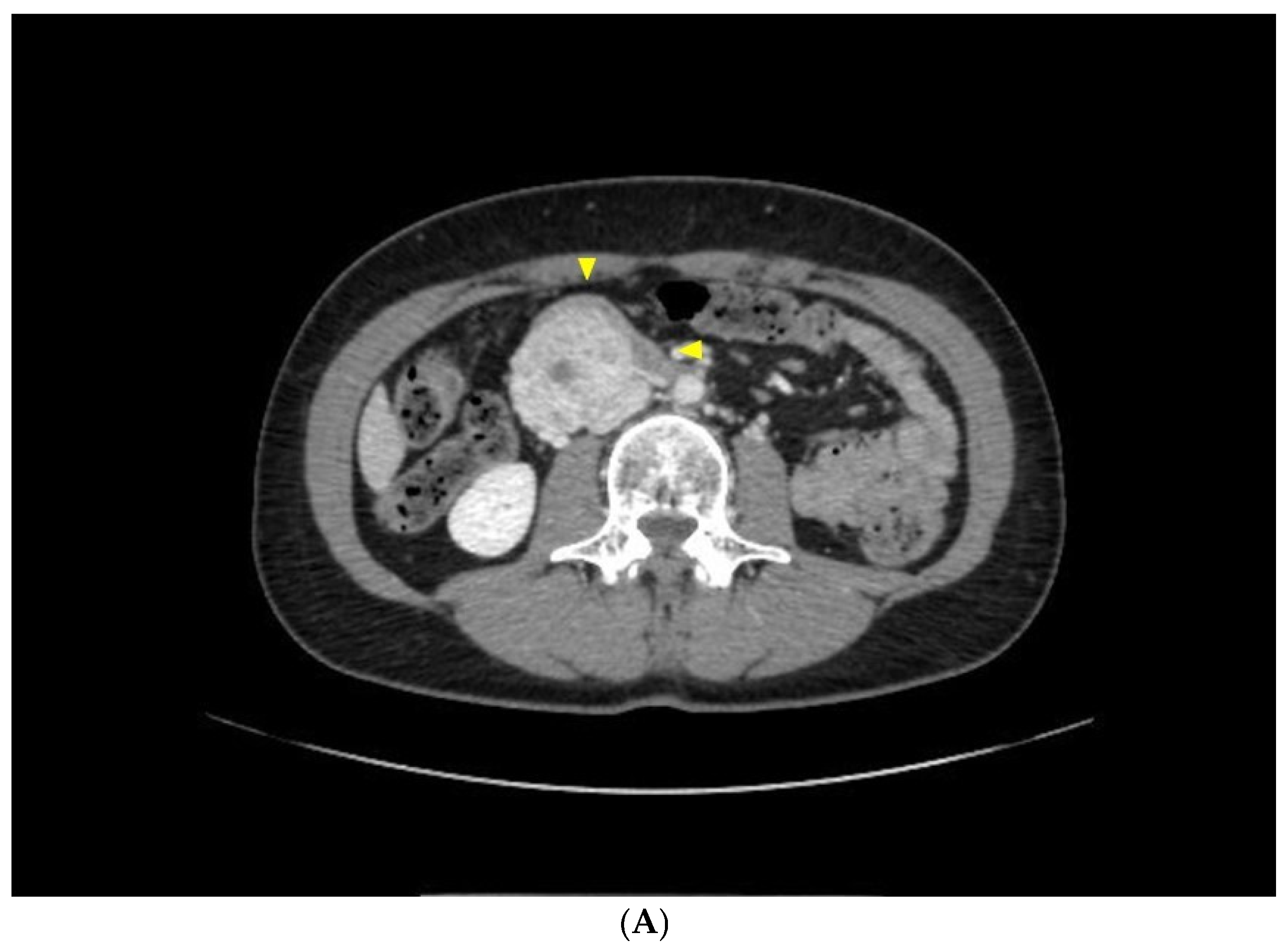 Diseases 12 00259 g002a