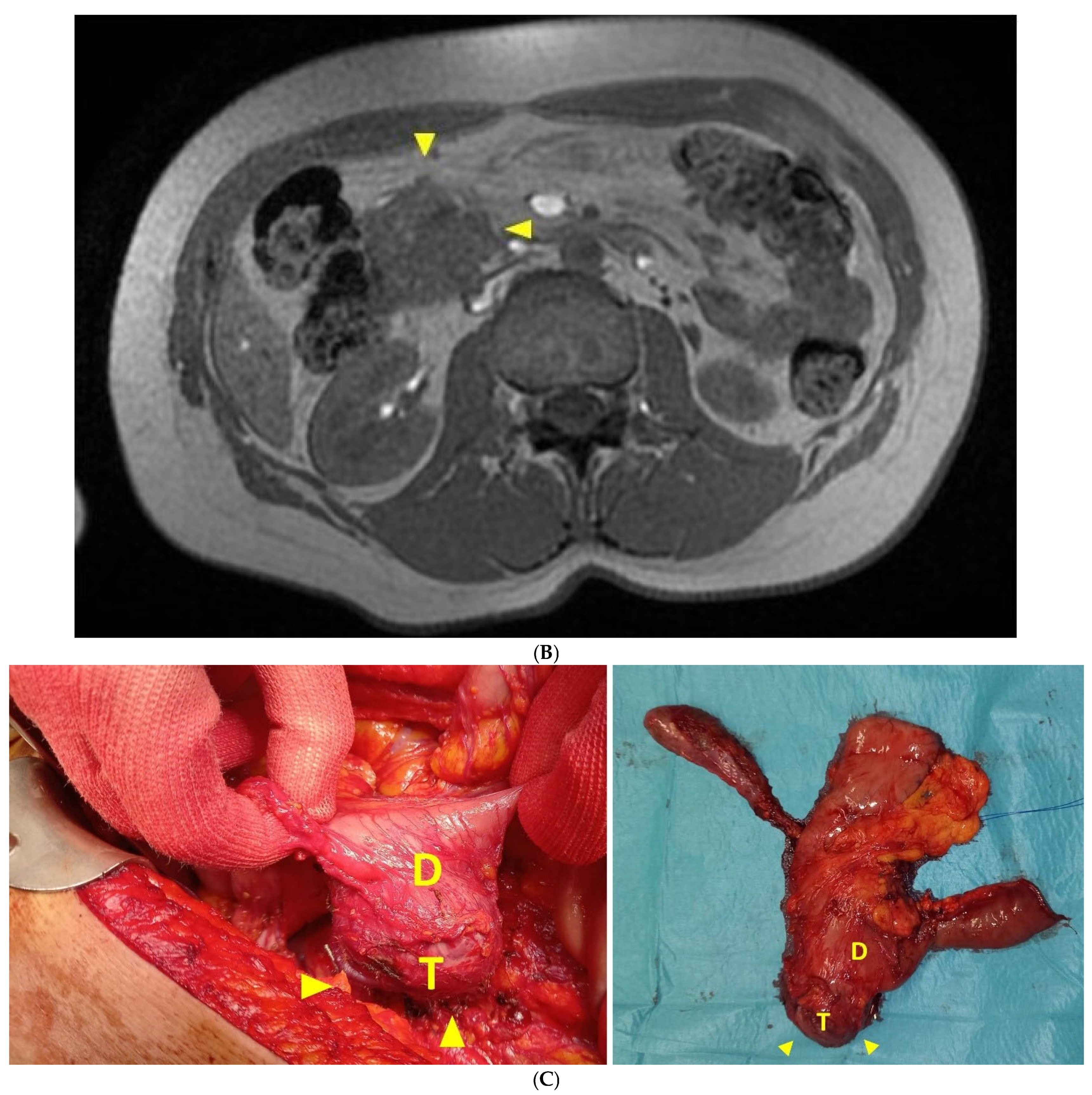 Diseases 12 00259 g002b