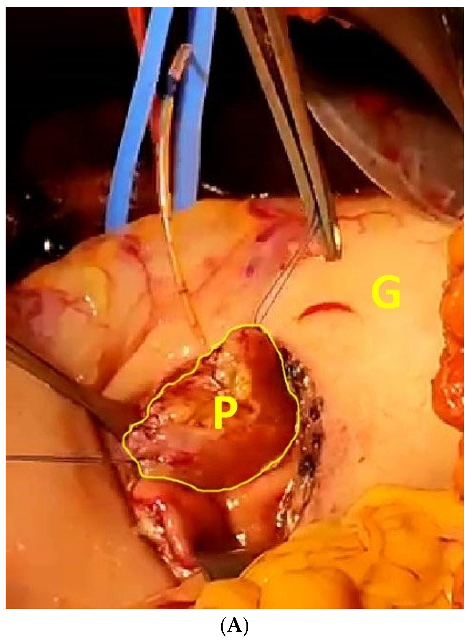Diseases 12 00259 g003a