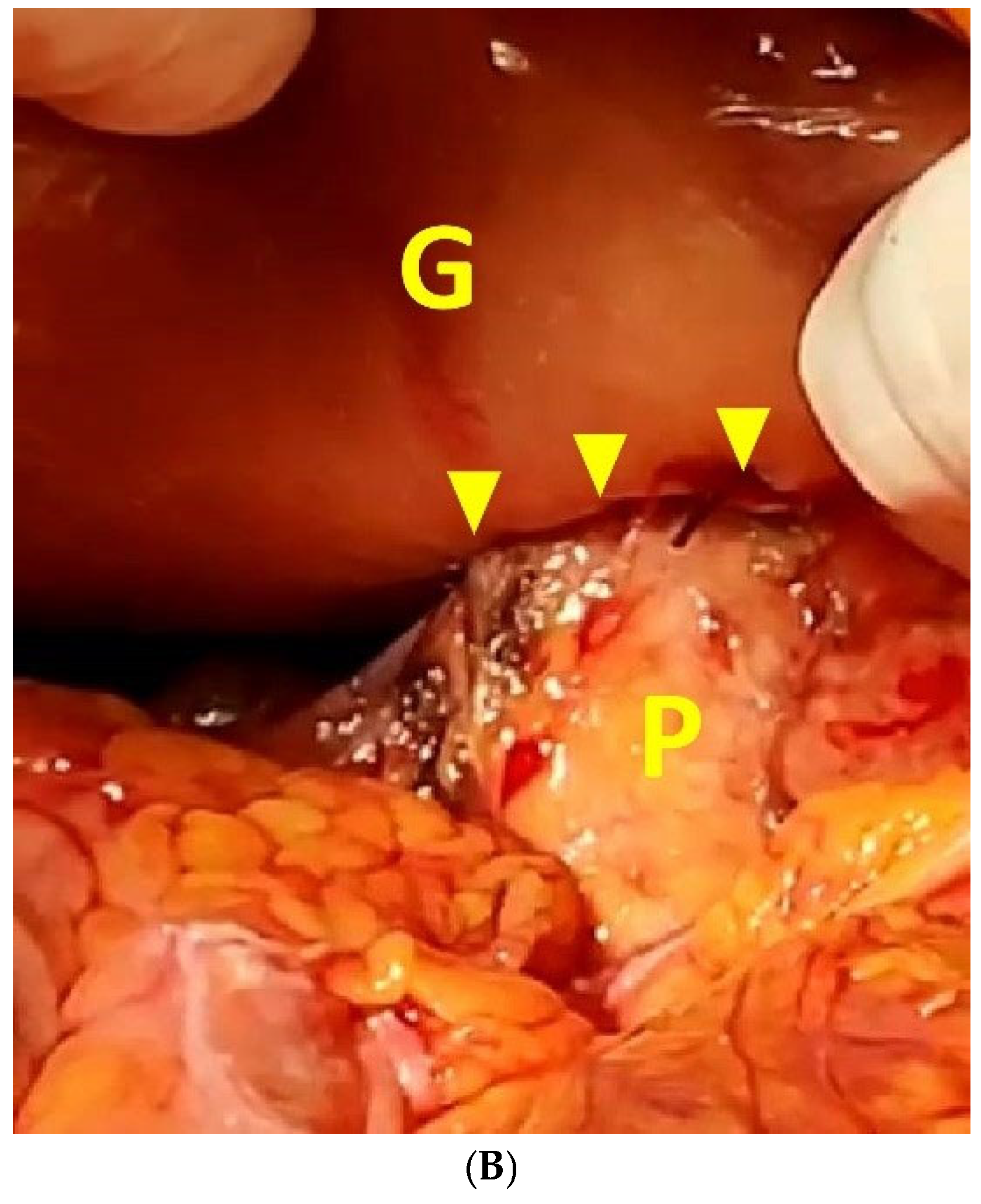 Diseases 12 00259 g003b
