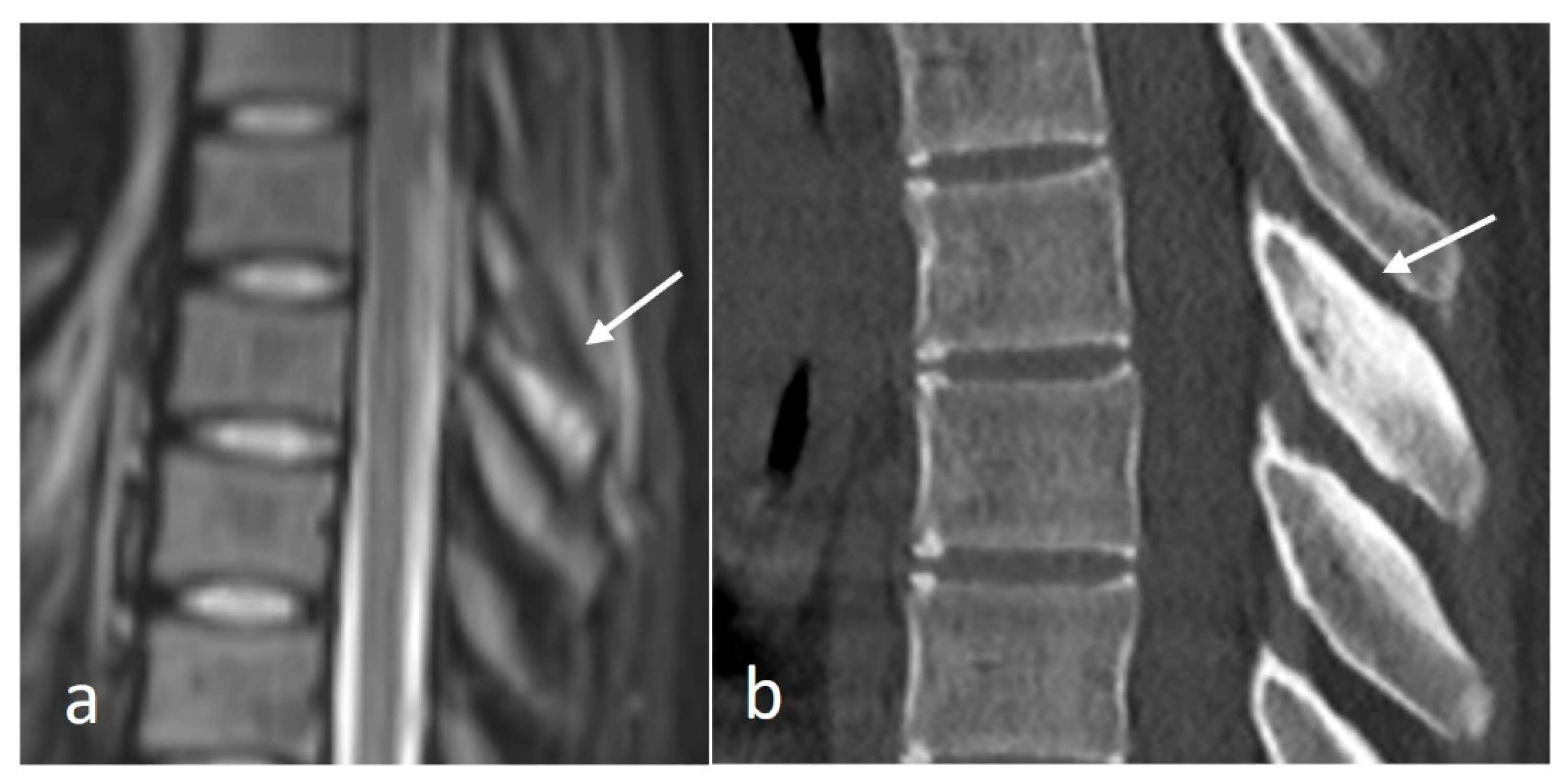 Diseases 12 00302 g002