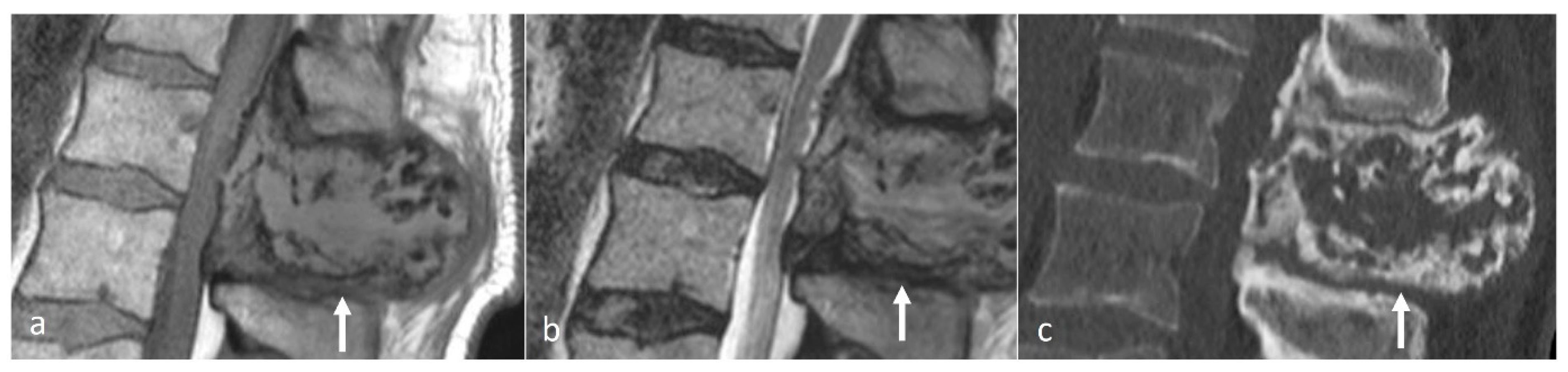 Diseases 12 00302 g006