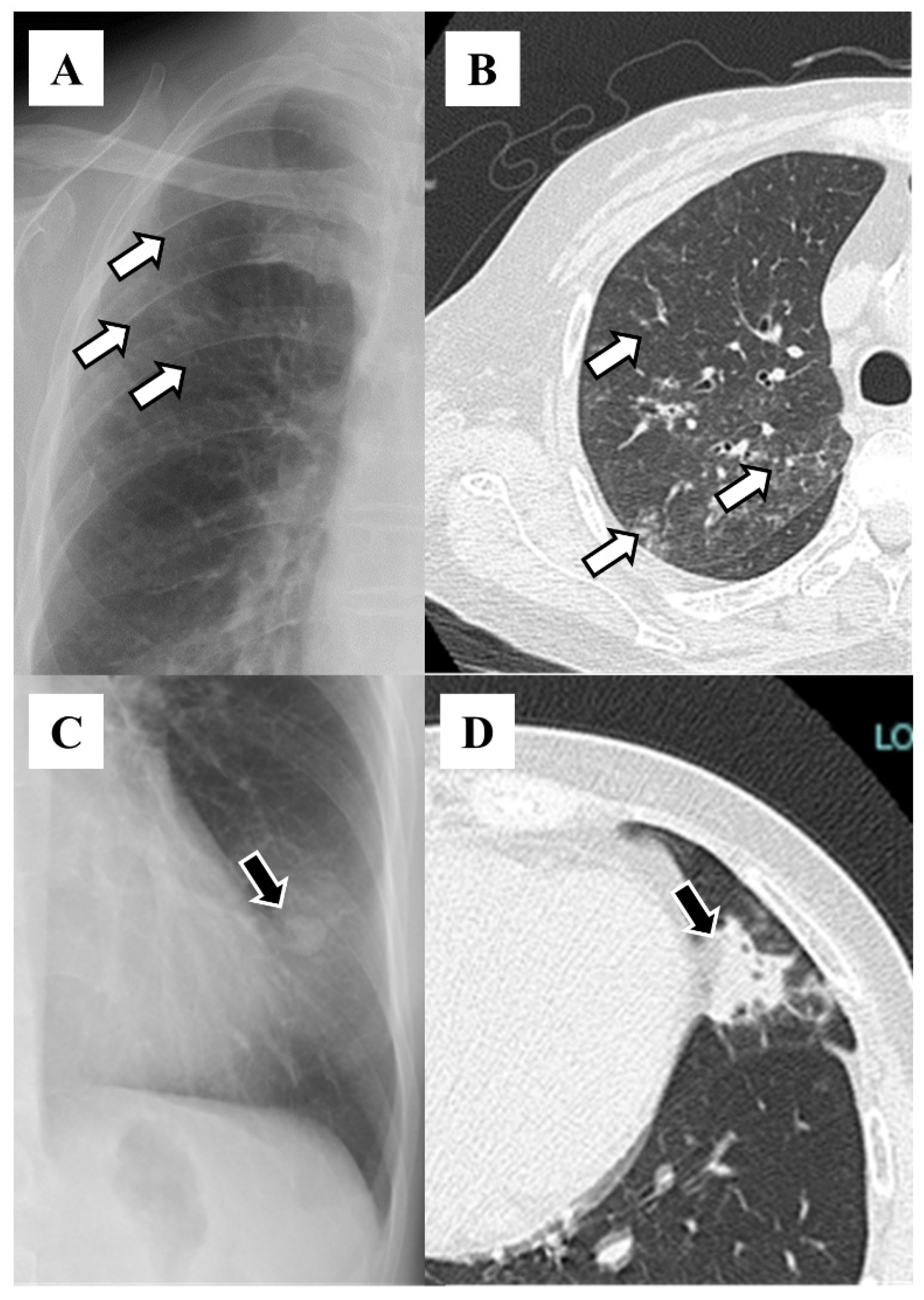 Diseases 12 00323 g001