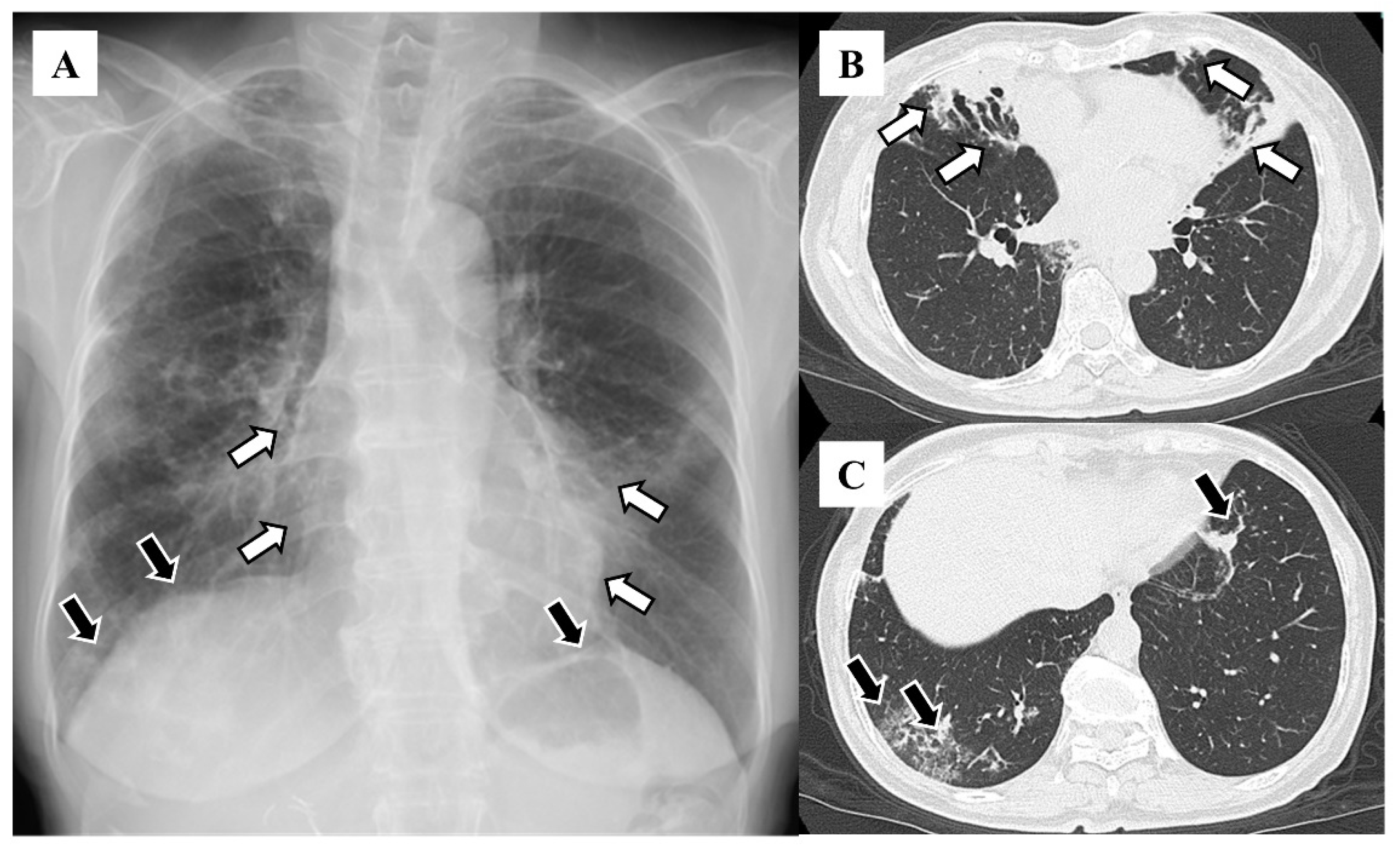 Diseases 12 00323 g002