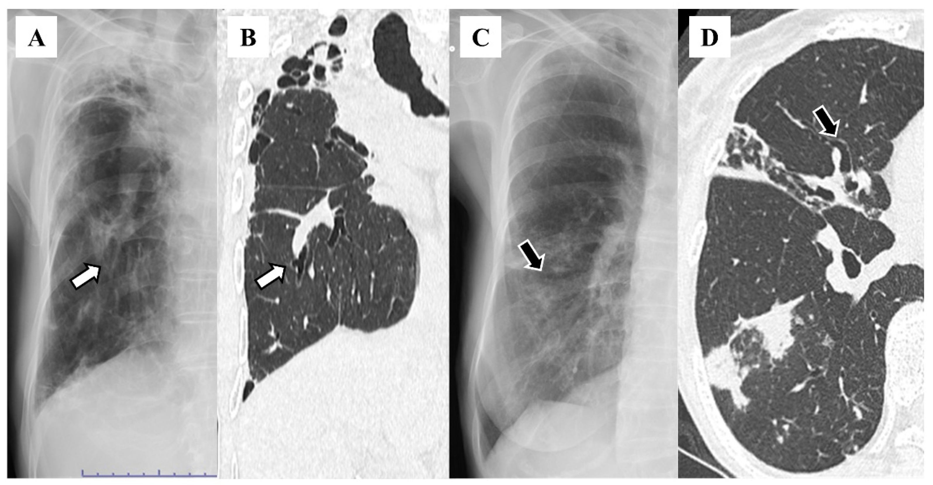 Diseases 12 00323 g003