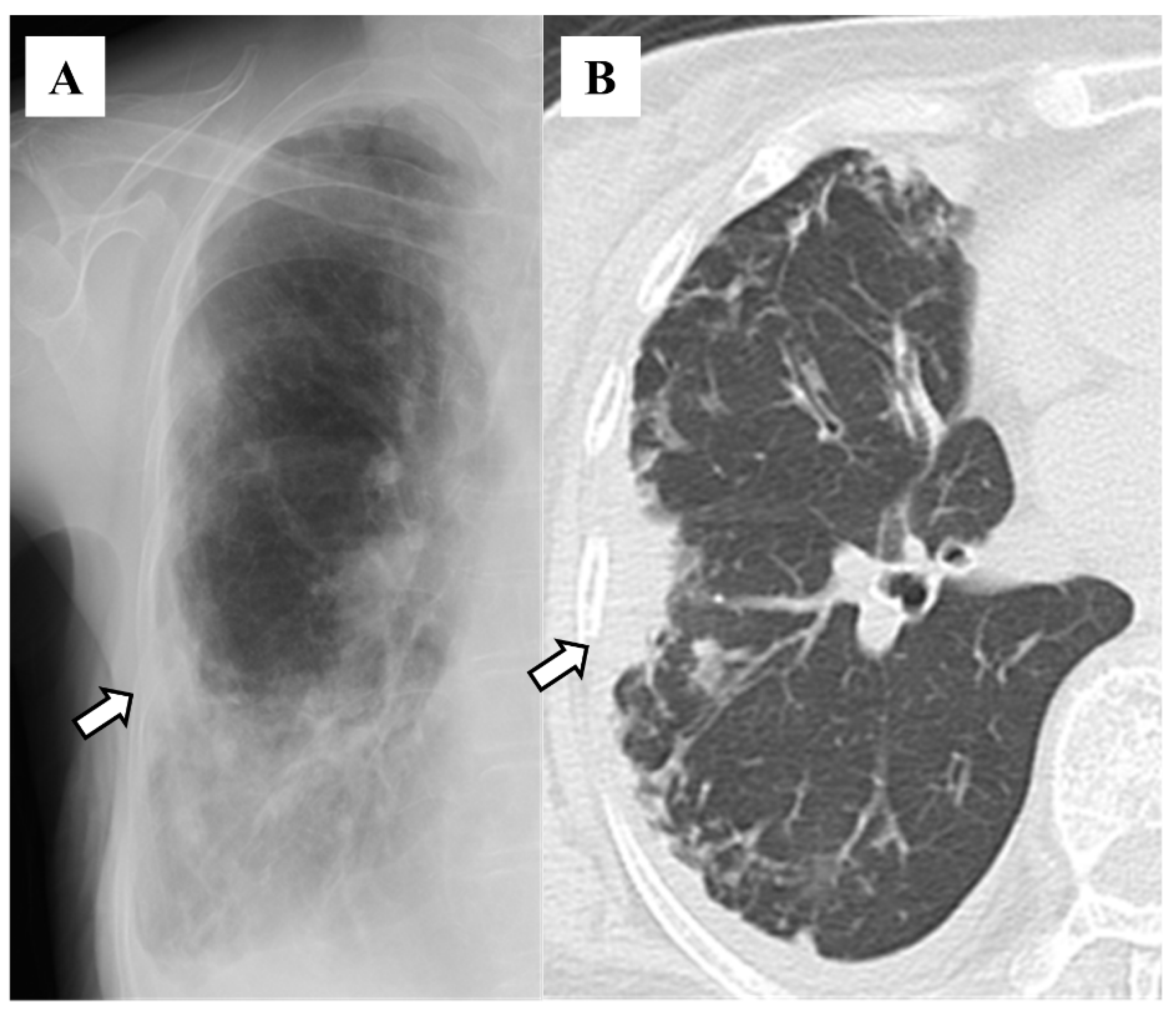 Diseases 12 00323 g004
