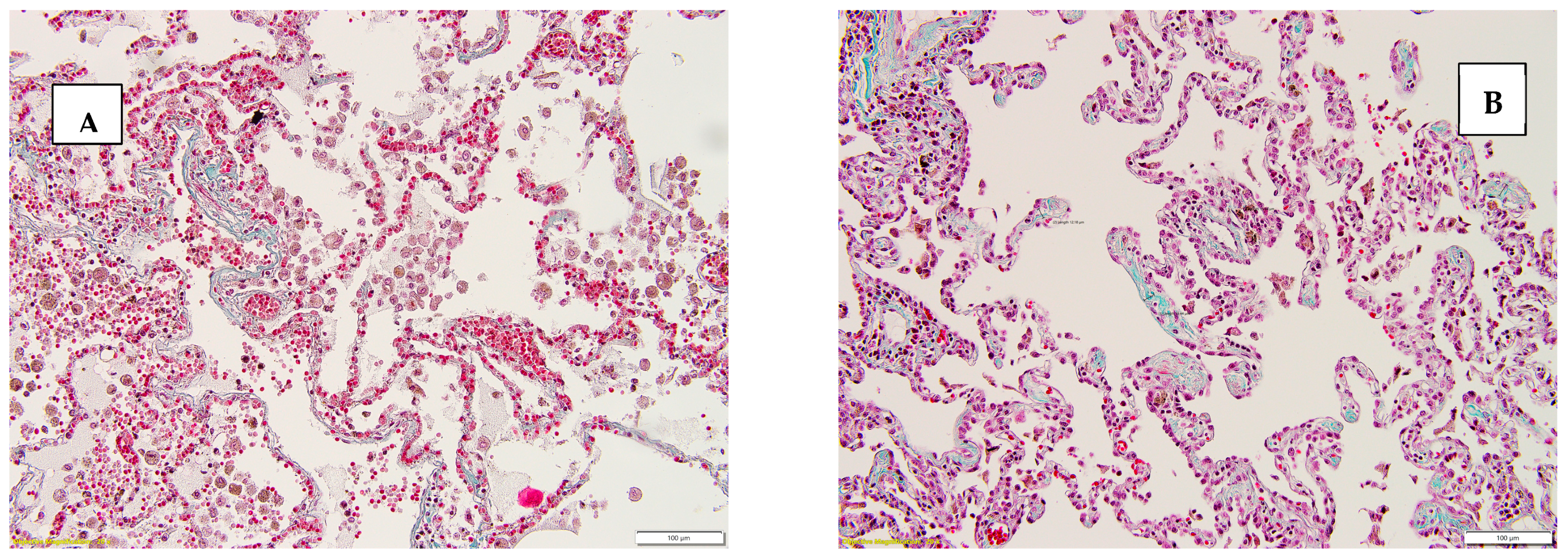 Diseases 13 00008 g001a