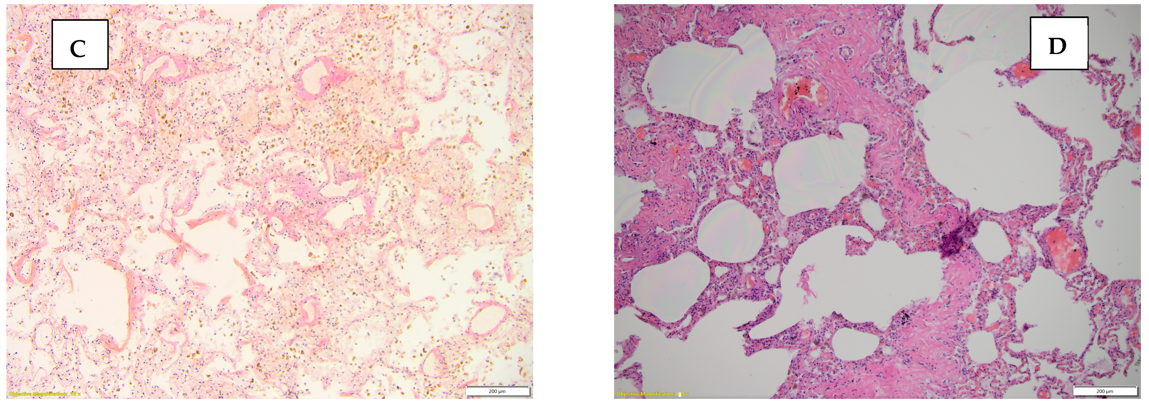 Diseases 13 00008 g001b