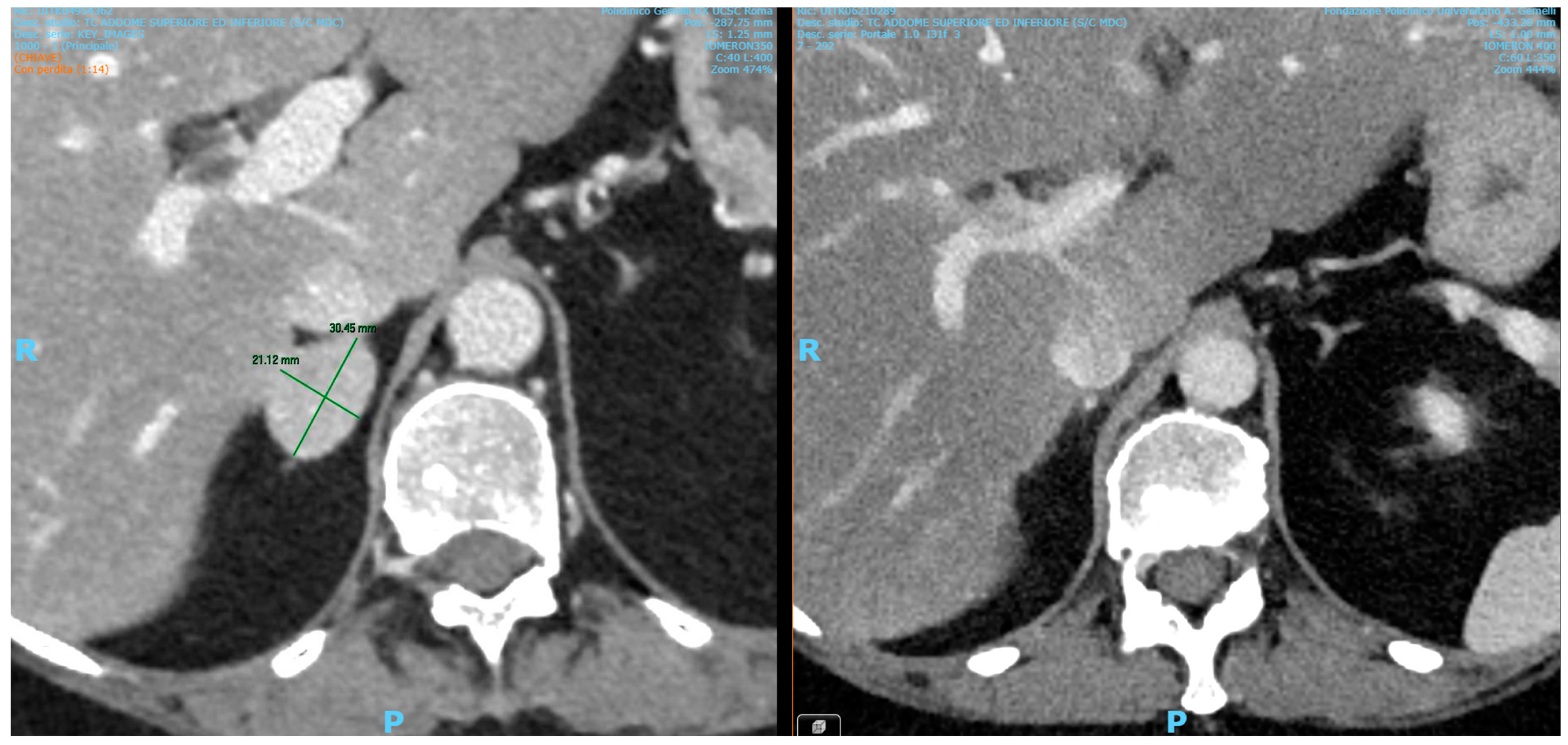 Diseases 13 00020 g001 Diseases 13 00020 g001