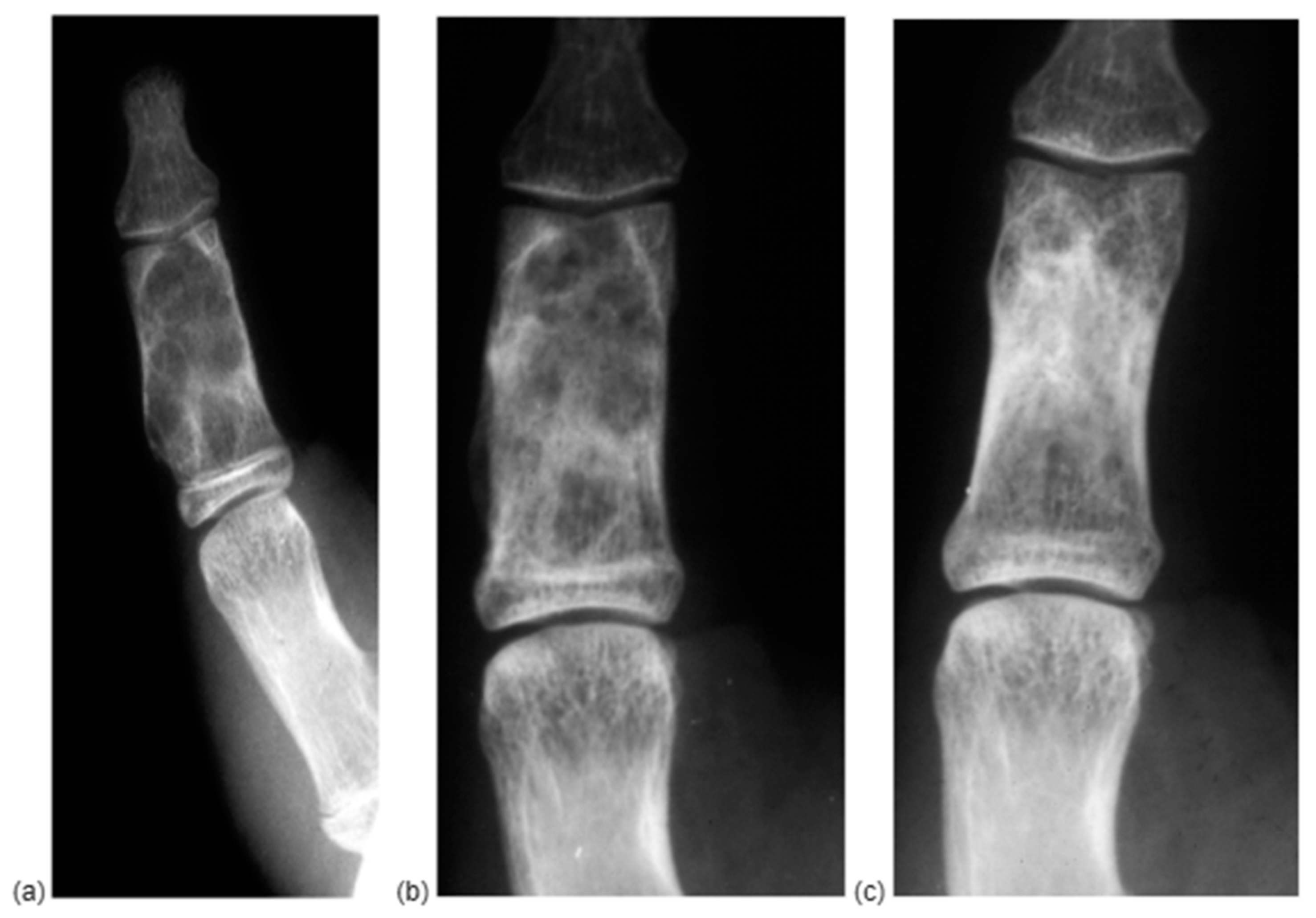 Diseases 13 00084 g004