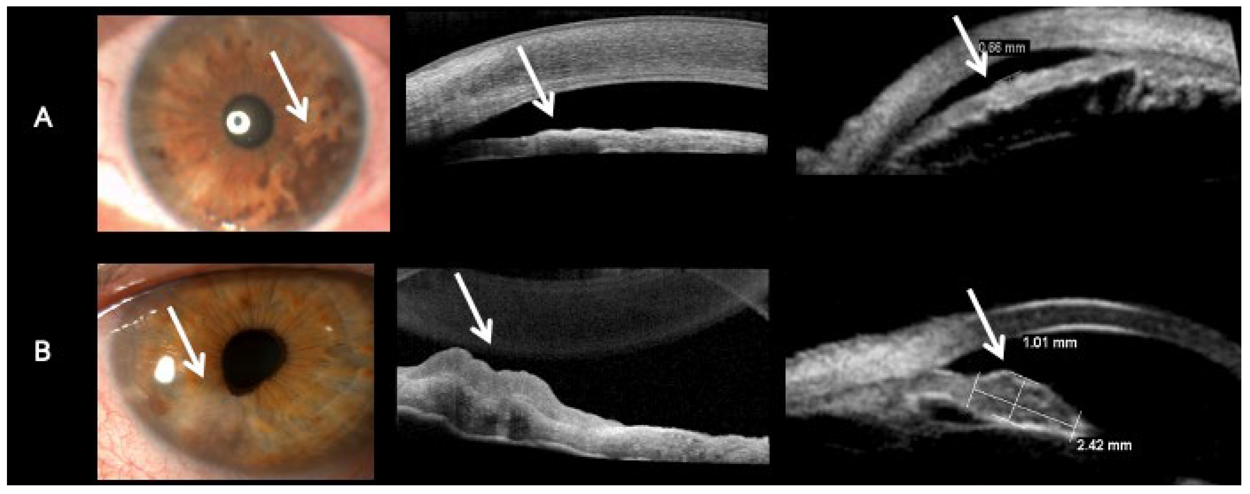 Diseases 13 00099 g004
