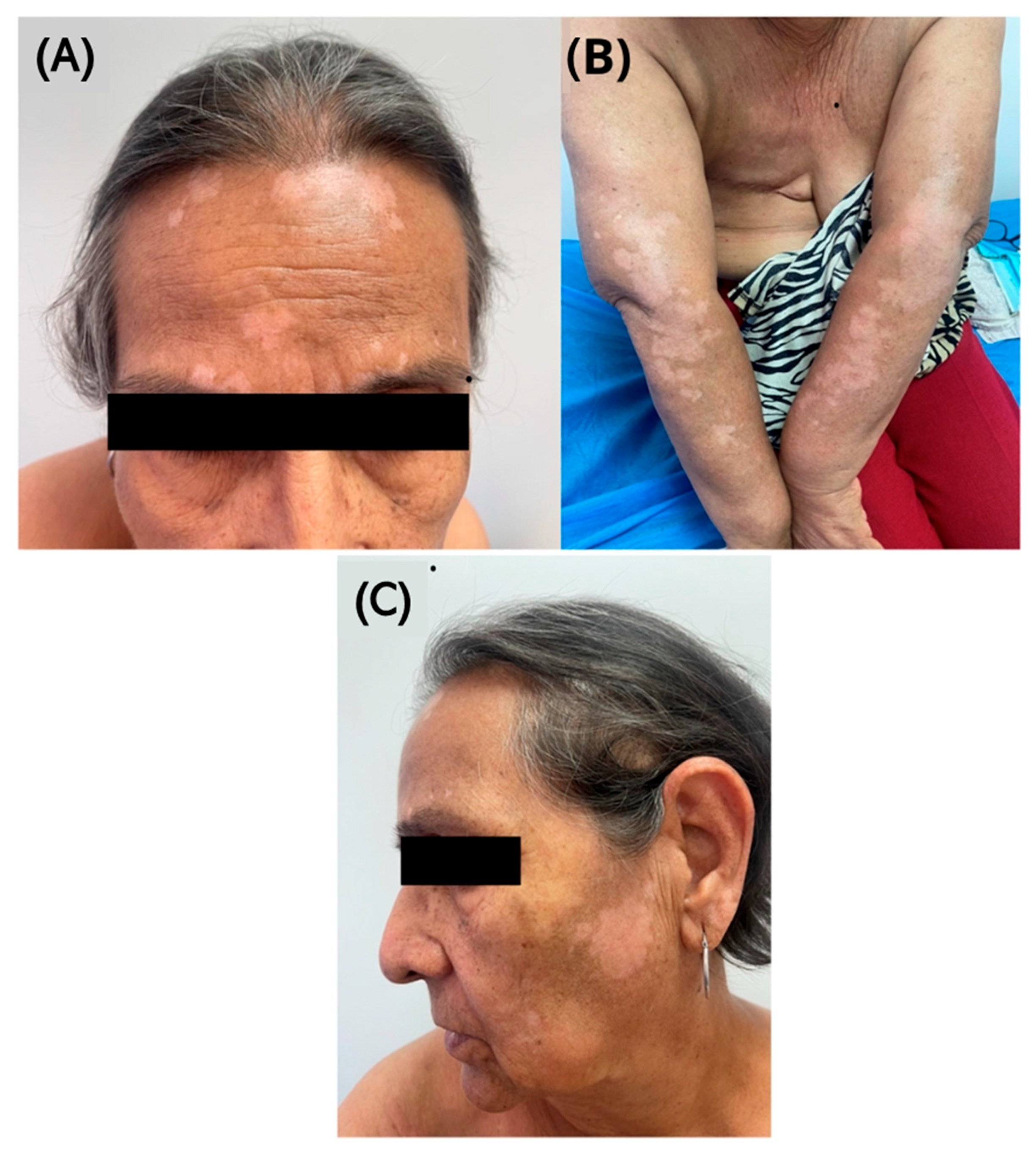 Diseases 13 00158 g002