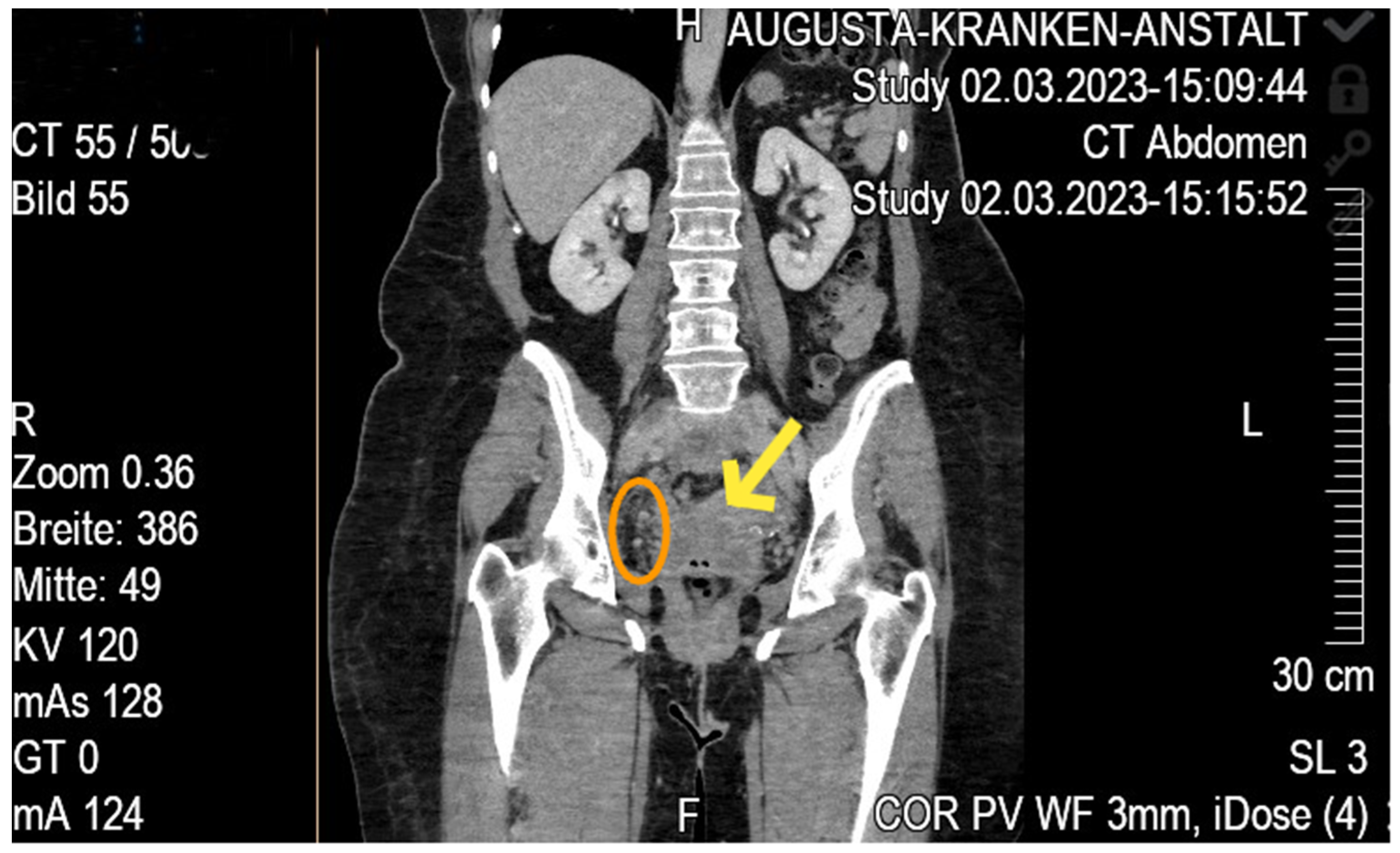 Diseases 13 00163 g001