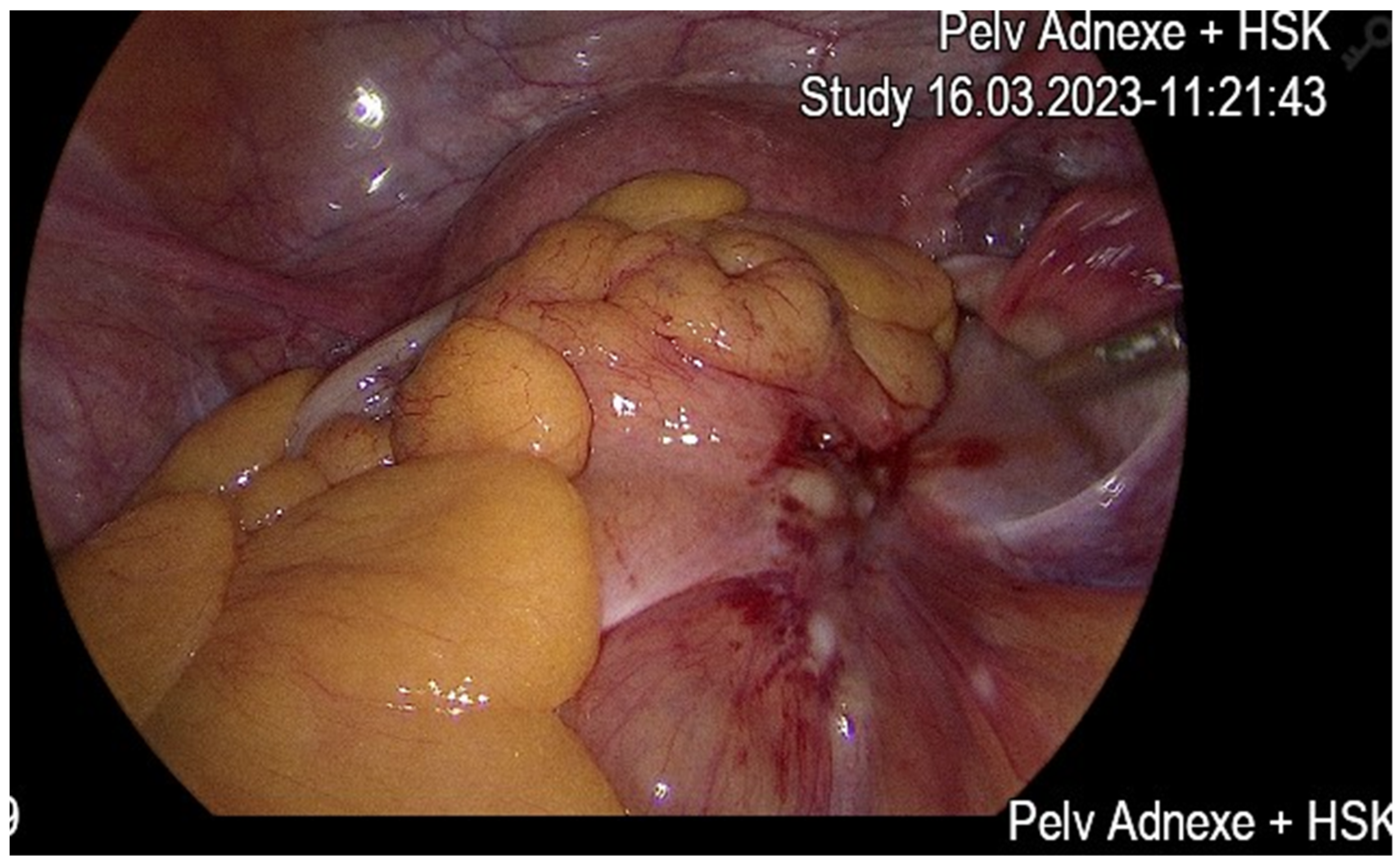 Diseases 13 00163 g002