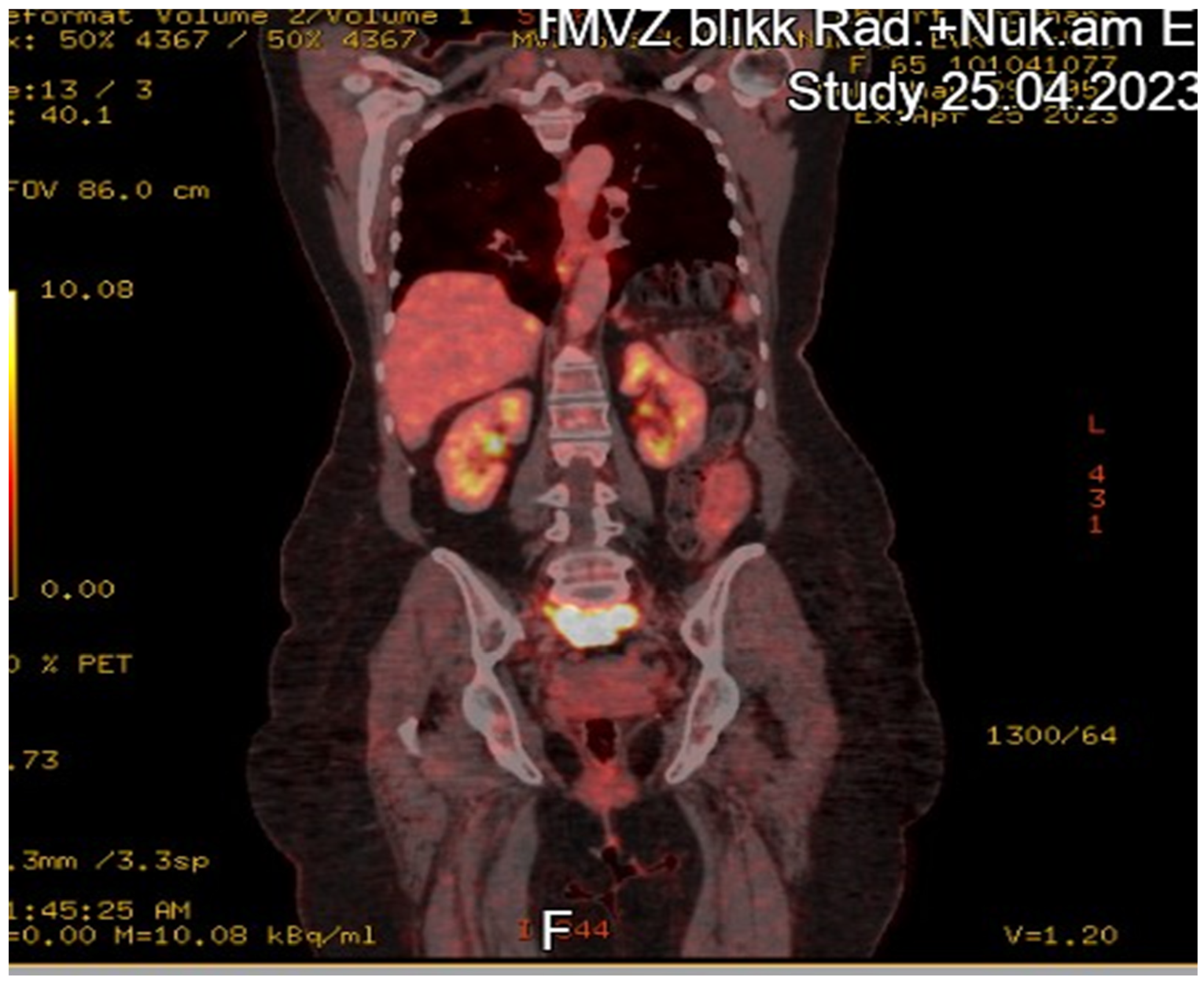 Diseases 13 00163 g003
