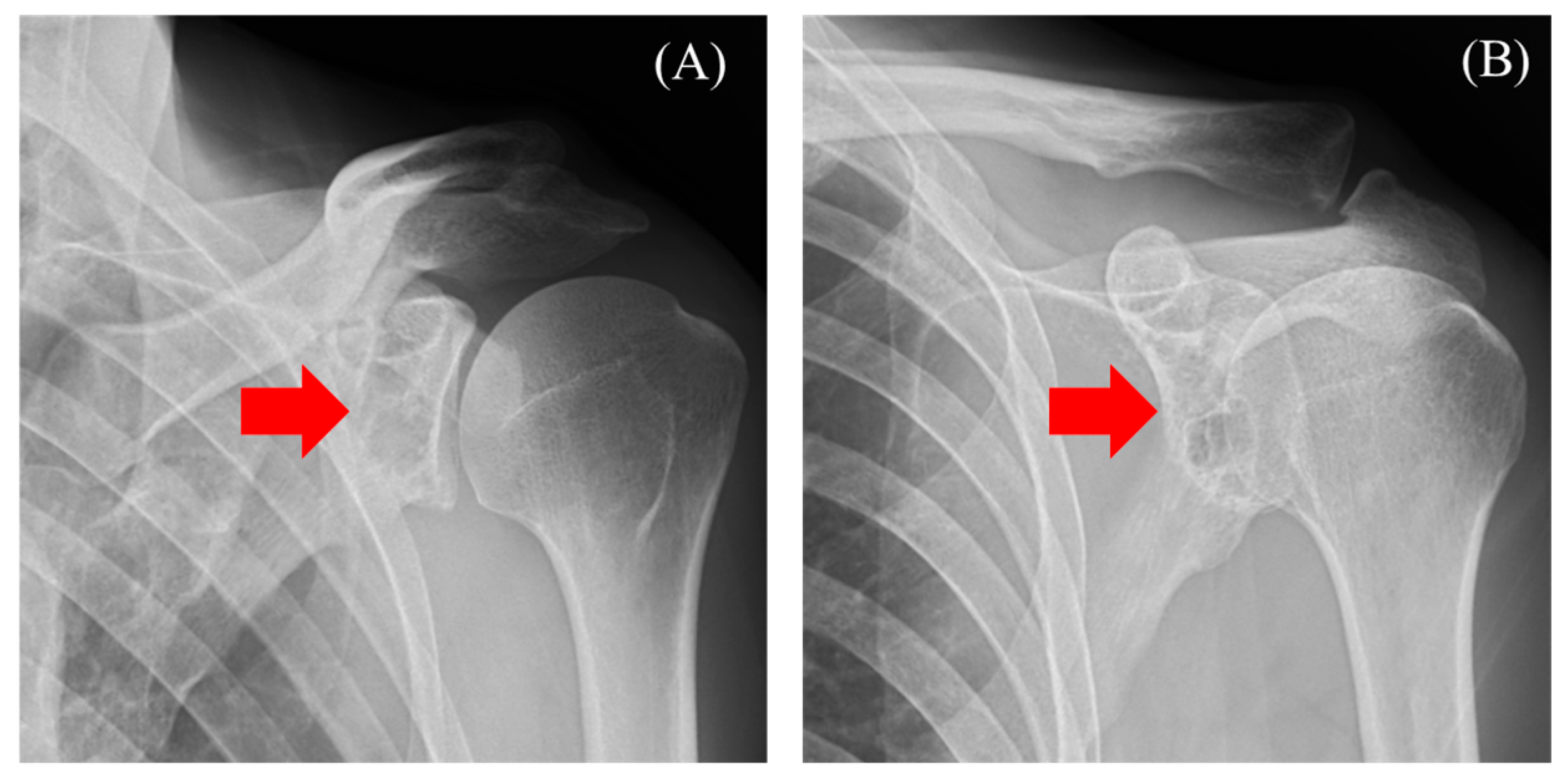 Diseases 13 00170 g001