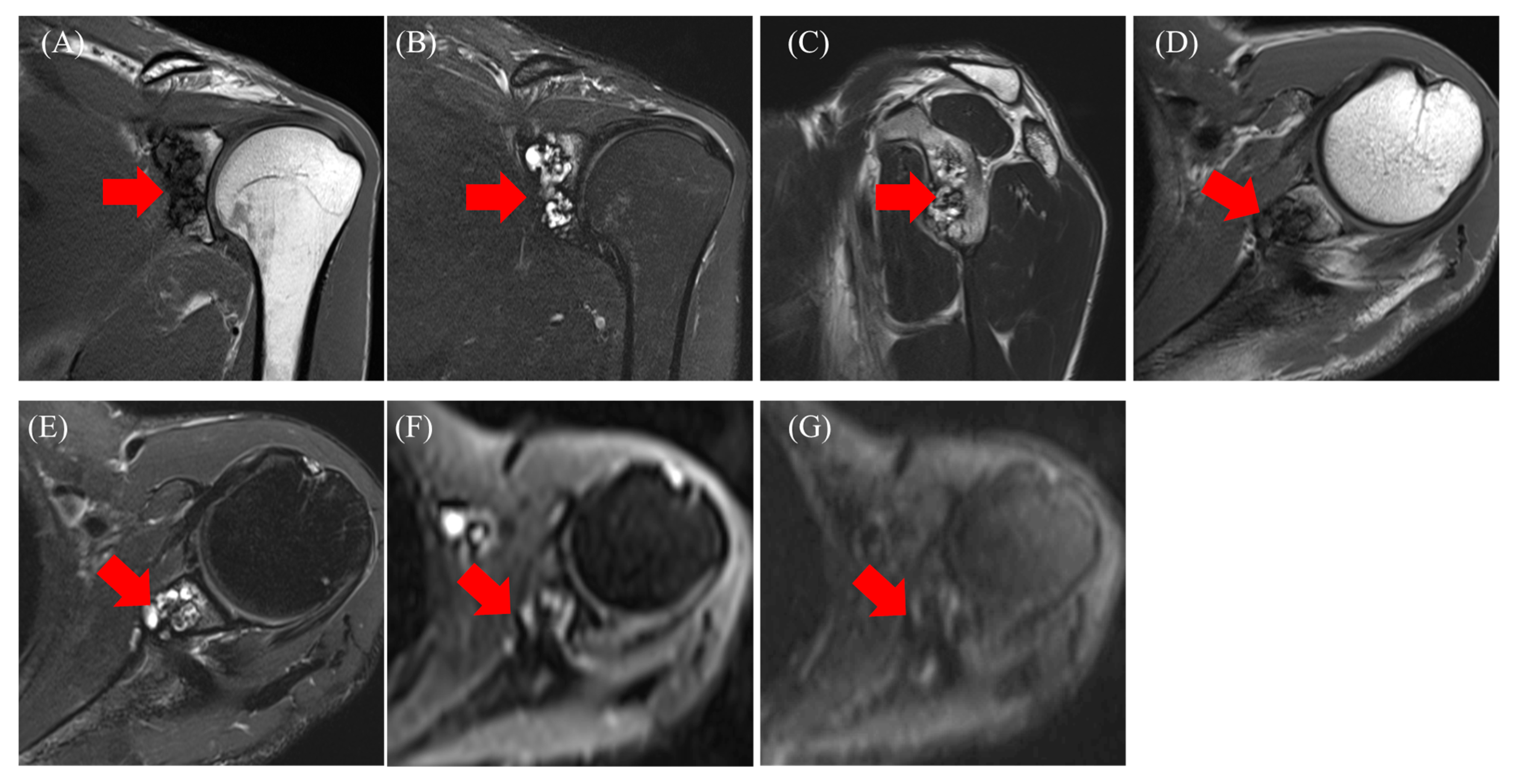 Diseases 13 00170 g002