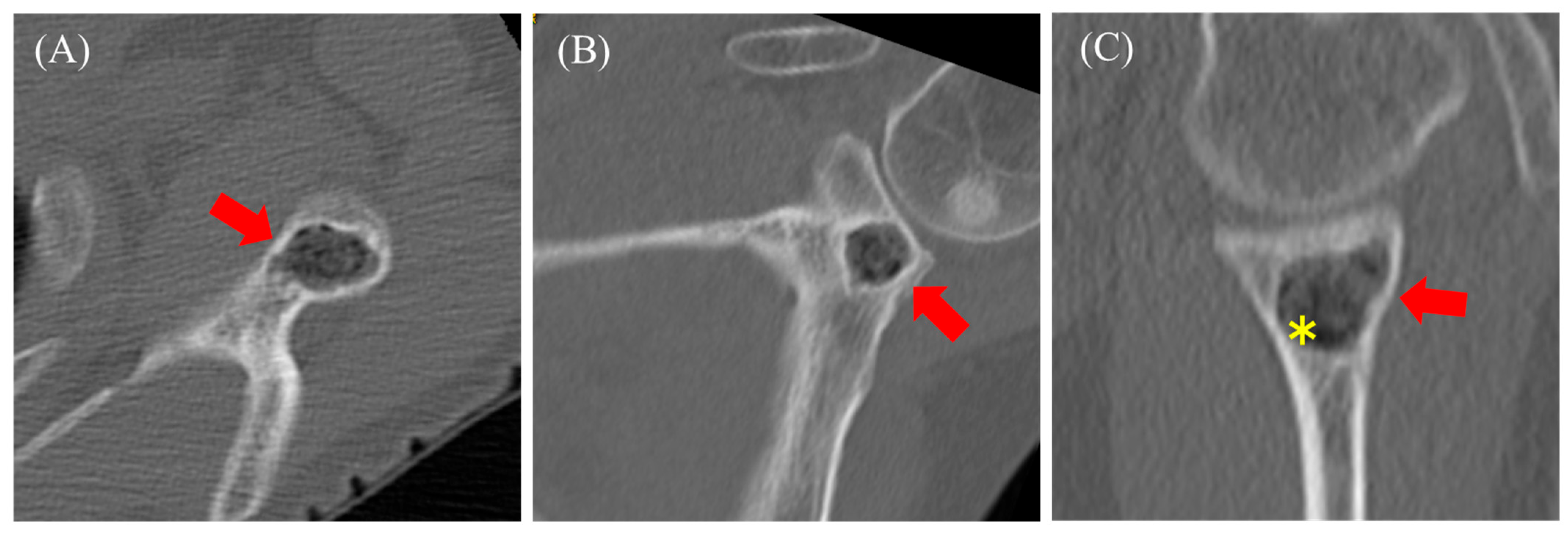 Diseases 13 00170 g006