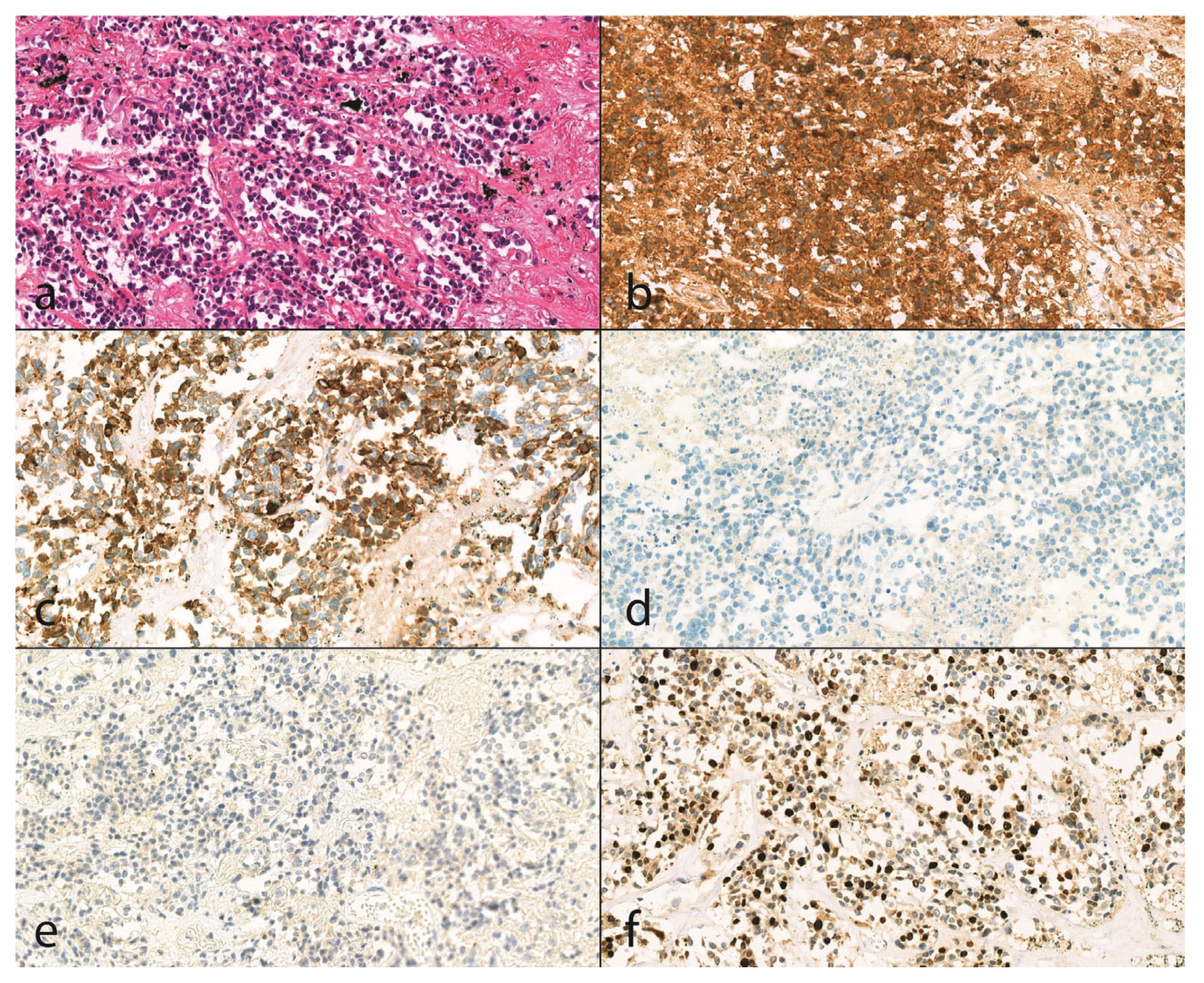 Diseases 13 00174 g001 Diseases 13 00174 g001